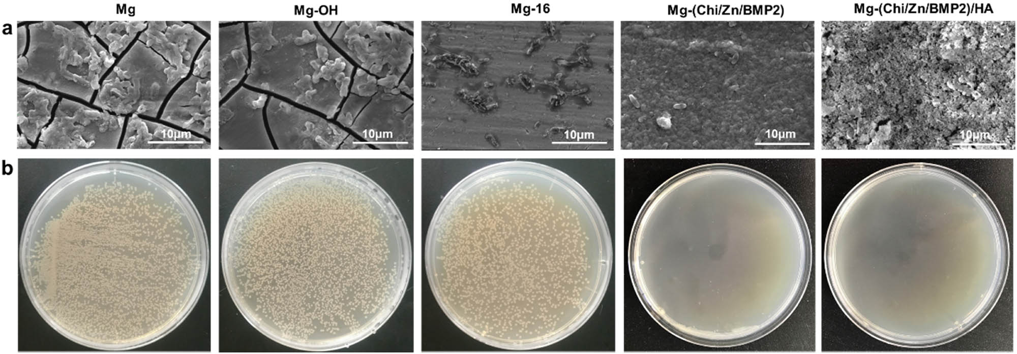 Figure 7 
                  Typical SEM images (a) and photographs of colonization (b) by E. coli on different surfaces of magnesium alloy.
               