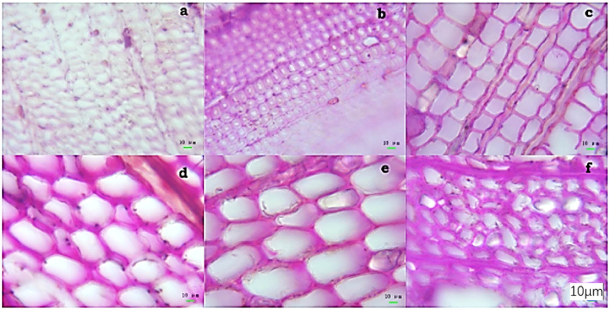 Figure 7 
                  Light micrograph section of (a) untreated eucalyptus; (b) treated eucalyptus; (c) treated Chinese fir; (d) untreated pine; (e) treated pine; and (f) poplar after burial for 377 days [68].
               