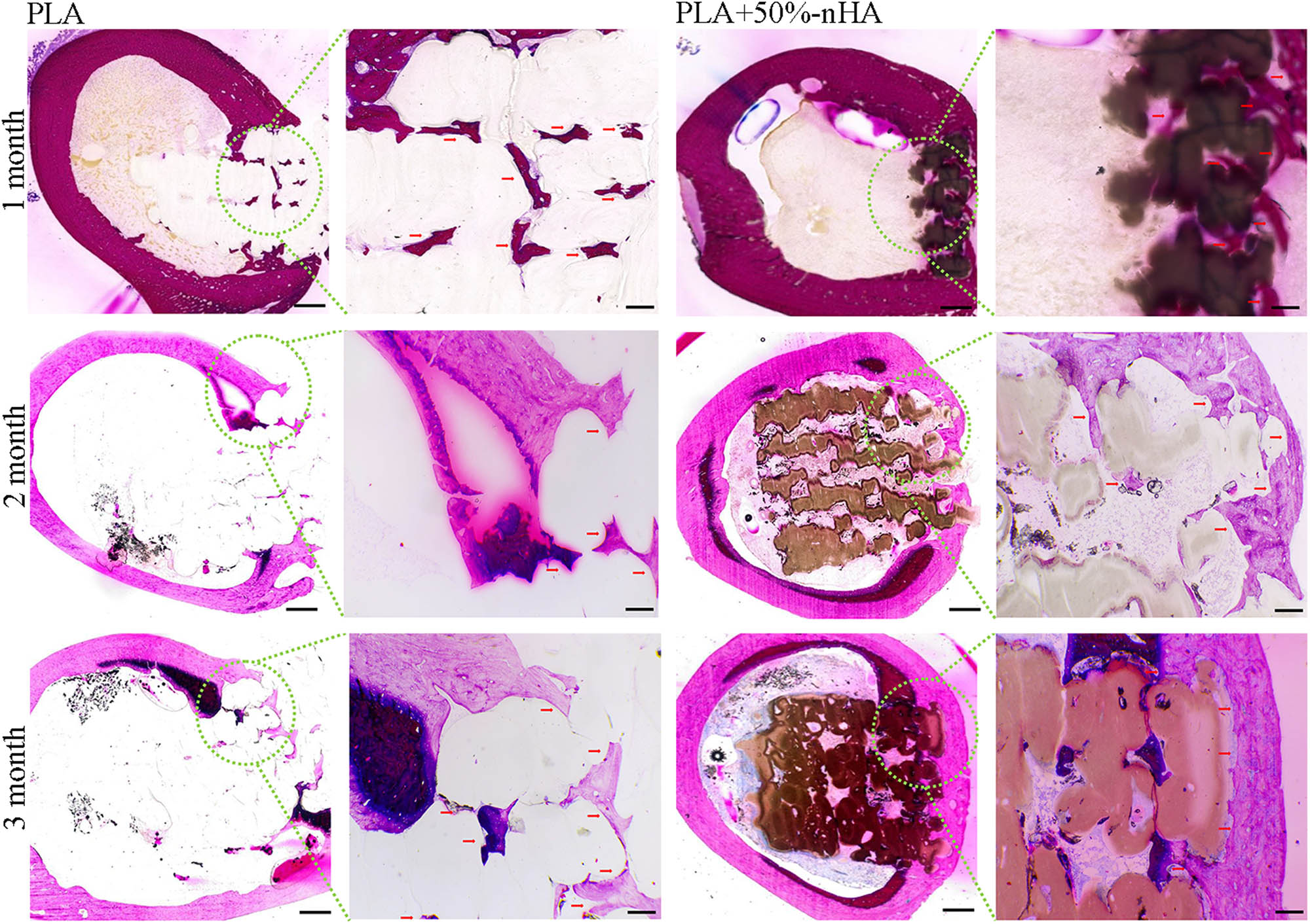 Figure 8 
                  Hematoxylin–eosin (HE) staining of the implanted scaffolds. New bone growth of PLA and PLA/n-HA composite scaffolds were observed at 1, 2, and 3 months after implantation. The observation of the whole interface are shown in the first and third columns.
               