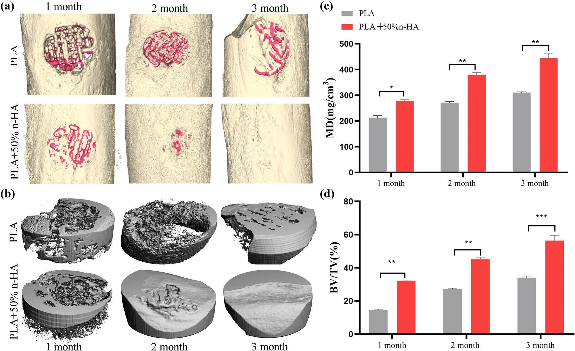 Figure 9 
                  Micro-CT analysis of the implanted scaffolds. The PLA and PLA/n-HA composite scaffolds were implanted into the defect of the rabbit femoral. (a) At 1, 2, and 3 months after scaffold implantation, the bone defect area was scanned using micro-CT, and 3D reconstruction was performed. The reconstructed scaffold was shown in red and the bone in gold; (b) the scaffold-implanted area of the cortical bone (5 mm in diameter and 2 mm in depth) was reconstructed in 3D; and (c and d) quantitative calculation of new bone growth based on CT data, mineral density (MD), and bone tissue volume (BV)/total tissue volume/(TV). *p < 0.05; **p < 0.01, ***p < 0.001.
               