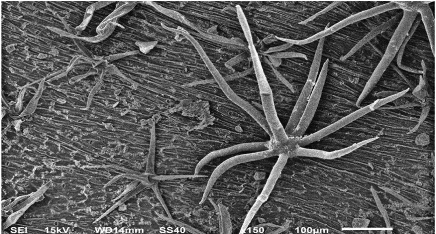 Figure 9 
                  SEM image showing the eggplant leaves sprayed with AgNPs.
               