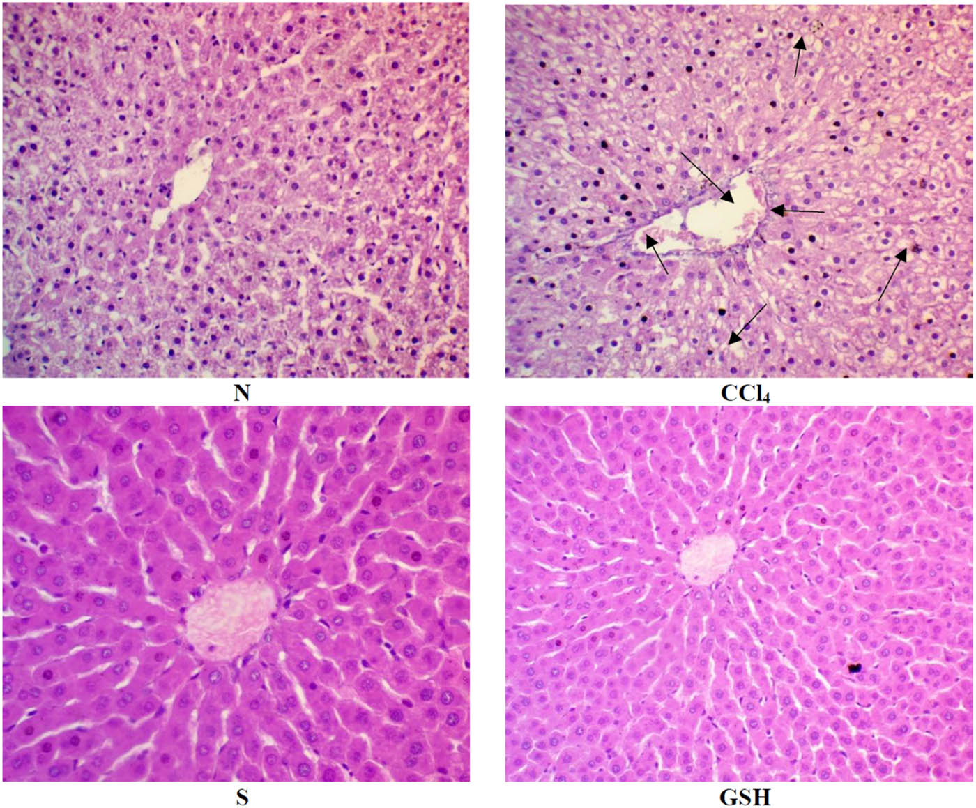 Figure 5 
                  Histopathology of rats’ liver (H&E stain). N = normal rats; CCl4 = injured rats; S = silymarin-treated rats; GSH = glutathione-treated rats.
               