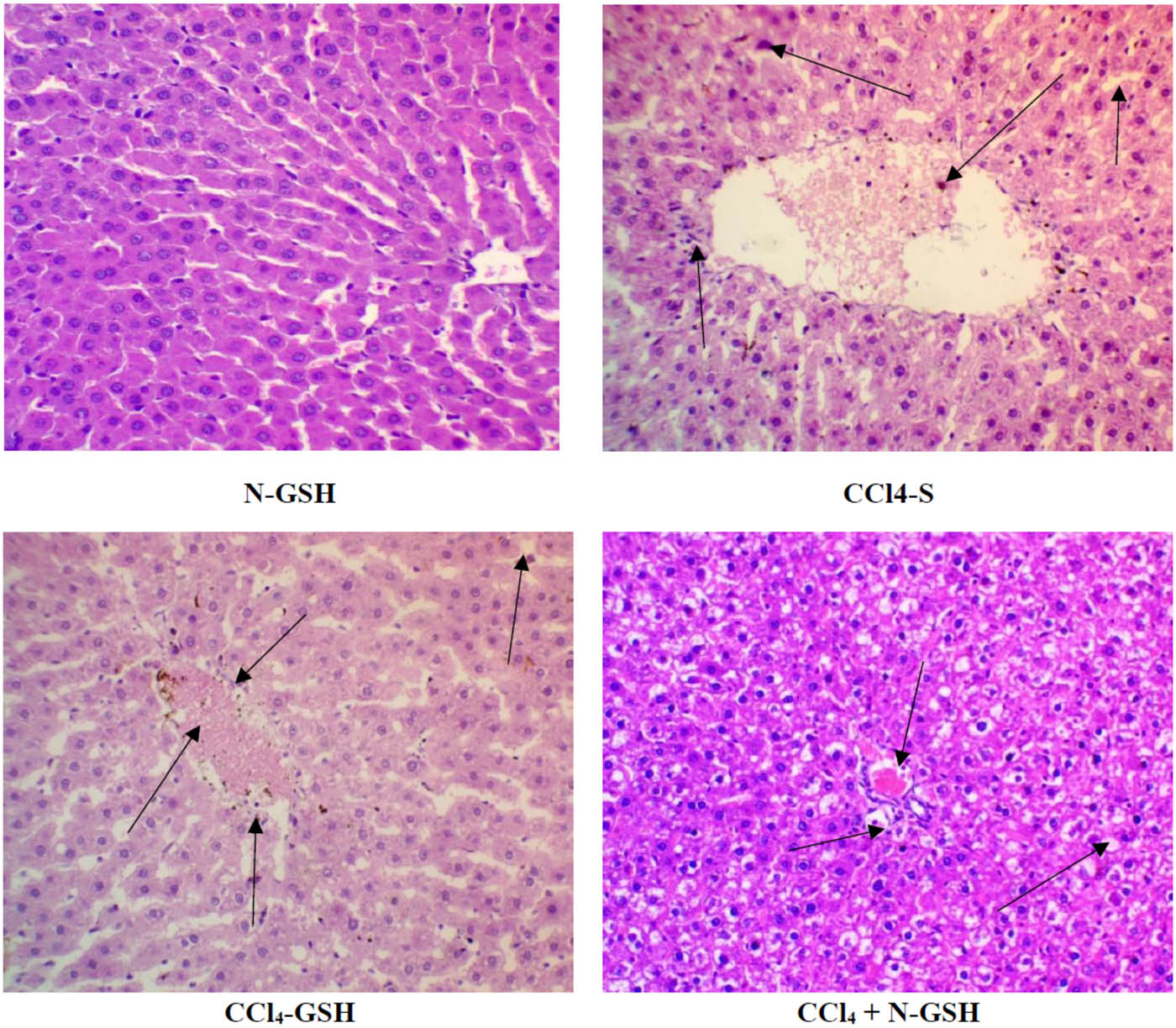 Figure 6 
                  Histopathology of rats’ liver (H&E stain). N-GSH = nano-glutathione-treated rats; CCl4-S = CCl4 + silymarin-treated rats; CCl4-GSH = CCl4 + glutathione-treated rats; CCl4 + N-GSH = CCl4 + nanoglutathione-treated rats.
               