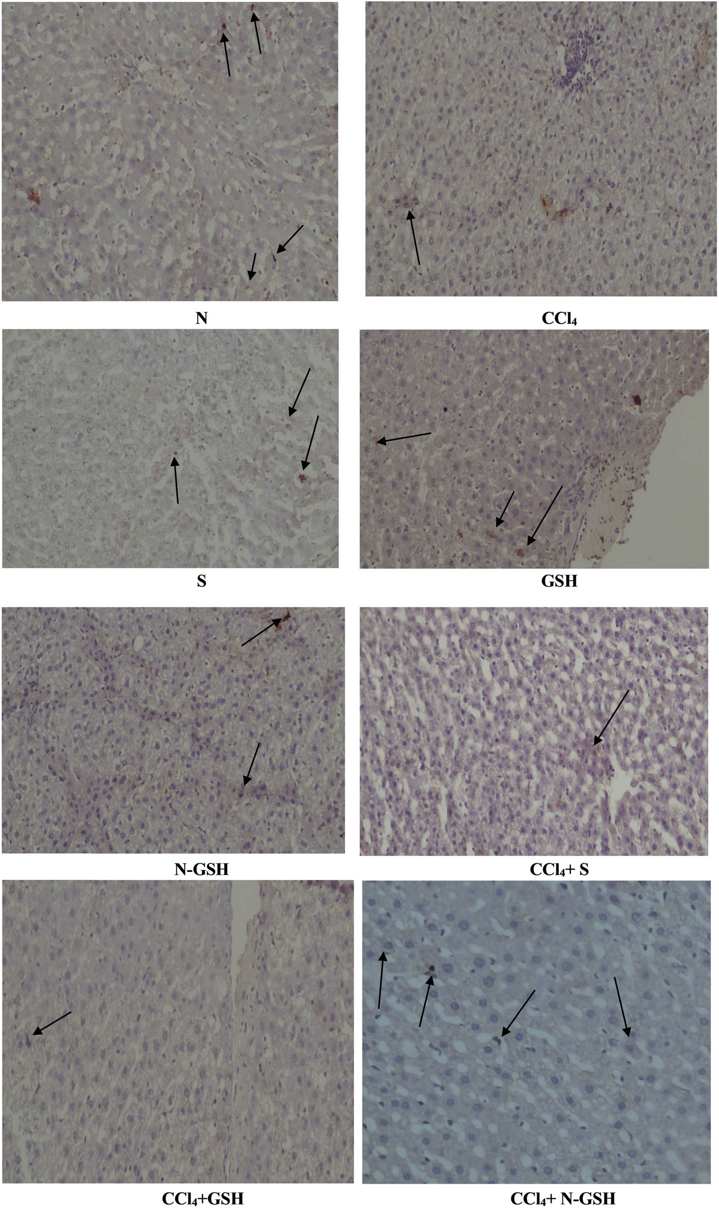 Figure 7 
                  Immunohistochemistry results of Bcl-2 on hepatic tissues of N, normal rats; CCl4, treated rats; S, silymarin-treated rats; GSH, glutathione-treated rats; N-GSH, nano-glutathione-treated rats; CCl4 + S, CCl4 + silymarin-treated rats; CCl4 + GSH, CCl4 + glutathione-treated rats; and CCl4 + N-GSH, CCl4 + nanoglutathione-treated rats.
               