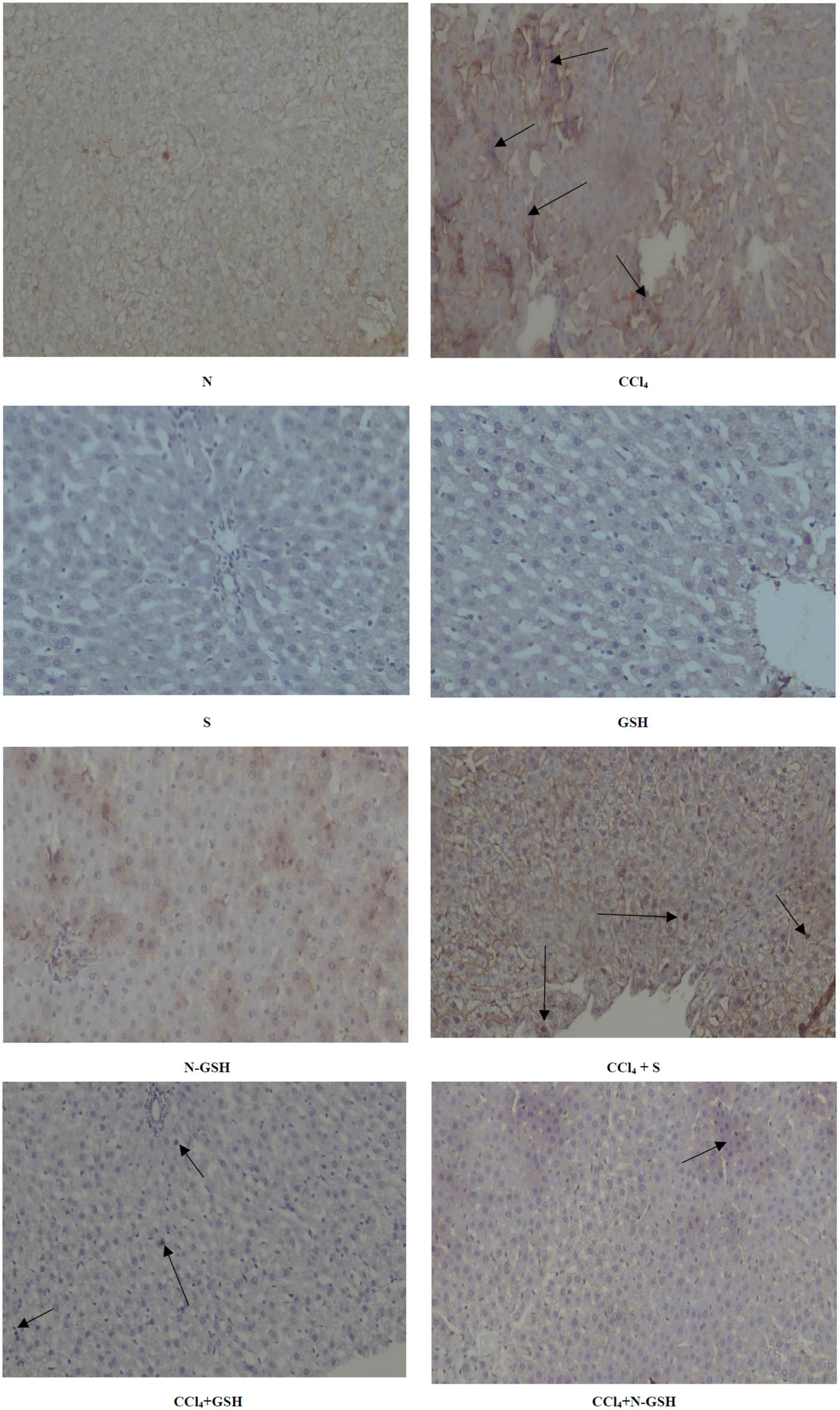 Figure 8 
                  Immunohistochemistry results of NF-Kβ on hepatic tissued of N, normal rats; CCl4, treated rats; S, silymarin-treated rats; GSH, glutathione-treated rats; N-GSH, nano-glutathione-treated rats; CCl4 + S, CCl4 + silymarin-treated rats; CCl4 + GSH, CCl4 + glutathione-treated rats; and CCl4 + N-GSH, CCl4 + nanoglutathione-treated rats.
               