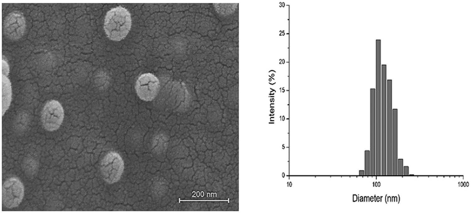 Figure 4 
                  SEM images of EGCG-T-NP (left) and corresponding particle size distribution (right). The scale bar is 200 nm.
               