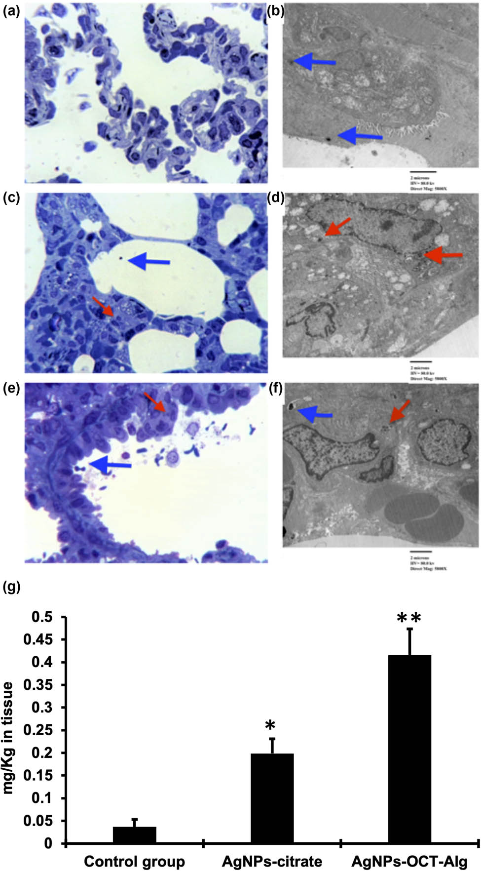Figure 7
(a–c) Photomicrographs of lung sections stained with toluidine blue. Panel b shows inhaled AgNPs–CTT (red arrow) and panel c shows inhaled AgNPs–OCT–Alg (red arrow); (d–f) transmission electron microscopy (TEM) photomicrographs of ultrathin lung sections; the irregularly shaped, comparatively larger black spots are artifacts shown by blue arrows; (e) inhaled AgNPs–CTT (red arrow); (f) inhaled AgNPs–OCT–Alg (red arrow); (g) the proportions of inhaled AgNPs–CTT, AgNPs–OCT, and AgNPs–OCT–Alg as determined by ICP-OES. The concentrations of AgNPs were 10 µM. *p < 0.05 versus control group, **p < 0.001 versus AgNPs–CTT group and control group.