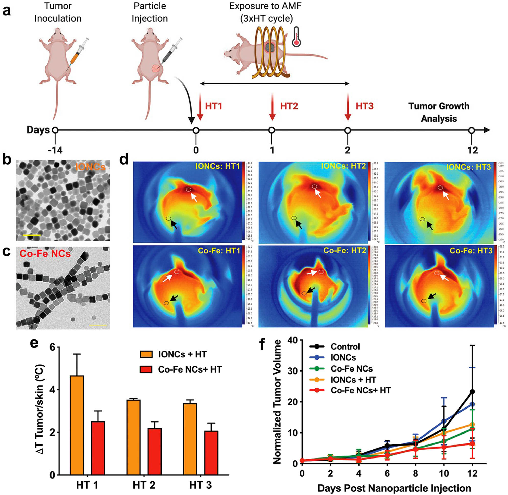 Figure 25 
               The efficiency of the ions possessing cubic shape-based hyperthermia and Co–Fe NCs during in vivo study. (a) Plan of the treatment. Particle injection is symbolized by a black arrow (0.7 mg Co–Fe NCs or 0.7 mg IONCs) and the days of HT therapy (3 × hyperthermia) are symbolized by red arrows, using AMF conditions. (b and c) TEM images of the ions possessing the cubic shape of particles (18 nm) (b) and sizes of poly(maleic anhydride-alt-1-octadecene‐coated CoFe2O4 was (17 nm) (c) In vivo studies. Scale bar: 50 nm. (d) Mouse IR images post the ions possessing cubic shape and CoFe2O4 injection during hyperthermia therapy (HT1, HT2, and HT3). Cancer temperature is represented by white arrows, while skin temperature is shown by black arrows, to estimate ΔT values. (e) ΔT graph (ΔT = T
                  Tumor − T
                  Skin) plotted for HT1 at day 1, HT2 at day 2, and HT3 at day 3 for (orange bars) the IONCs (in vivo) or (red bars) Co–Fe NCs. (f) Tumor or cancer growth curve represented the marginal decrease in cancer growth for Co–Fe NCs and exposed to 3× hyperthermia (Co–Fe NCs + hyperthermia) compared to Control, the ions possessing cubic shape alone; Co–Fe NCs alone, and the ions possessing cubic shape + hyperthermia; N = 6. Adapted from ref. [146] with permission from John Wiley and Sons.
            