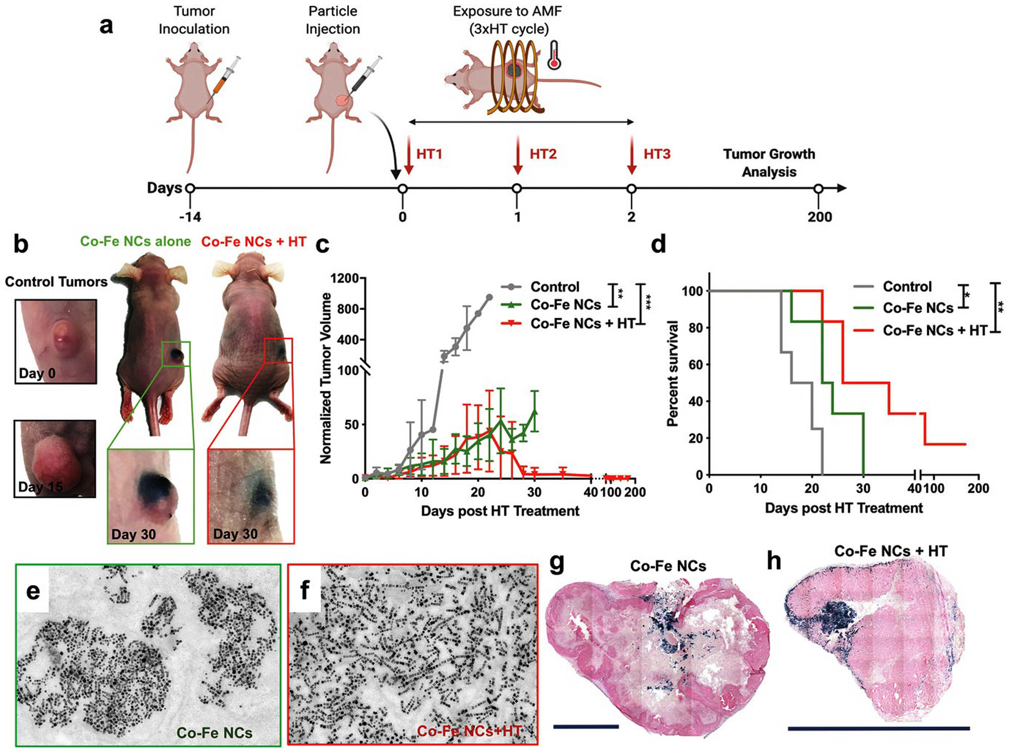 Figure 26 
               The efficacy of Co–Fe NCs during in vivo HT examination. (a) Diagram of plan therapy. (b) Images of a control animal (at 0 and 15 days) and Co–Fe NCs injected alone, and Co–Fe NCs injected + hyperthermia display the decrease and whole eradication of cancer 30 days after treatment, respectively. The treated cancer is represented by an enlarged image in boxes. (c) The complete eradication of cancer represented in tumor or cancer growth curve and no relapse up to 200 days in case of Co–Fe NCs + hyperthermia (in vivo). (d) A Kaplan–Meier survival graph indicating Co–Fe NCs + hyperthermia enhanced the survival rate up to 200 days after therapy, while in other groups for only one month. (e and f) TEM images proved that cancer cells have a chain shape even at one month after therapy for both Co–Fe NCs alone (e) and Co–Fe NCs + hyperthermia (f). (g and h) Light microscopy images of cancer slices of Co–Fe NCs alone (g) and Co–Fe NCs + hyperthermia (h) display the incidence of NPs and absence of stroma. Blue color representsNPs due to Prussian blue staining; dark-pink stained the collagen and light-pink stained the cells in the case of Fast Red staining. Scale bars in (g) and (h) are 0.5 cm. Adapted from ref. [146], with permission from John Wiley and Sons.
            