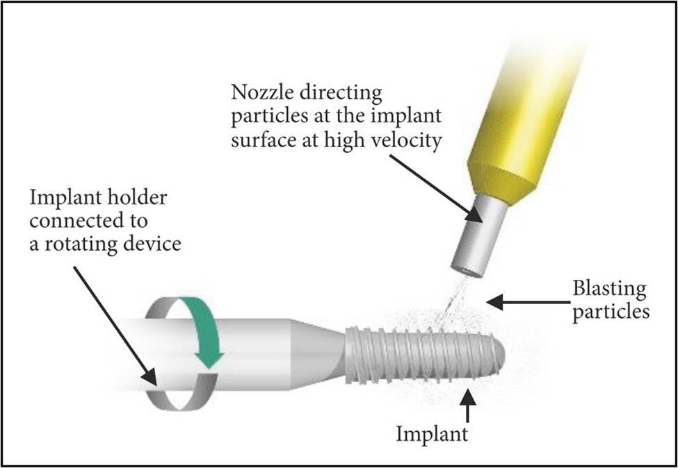 Figure 1 
                     Schematic illustration of the SB process [49]. Copyright 2014, Hindawi.
                  