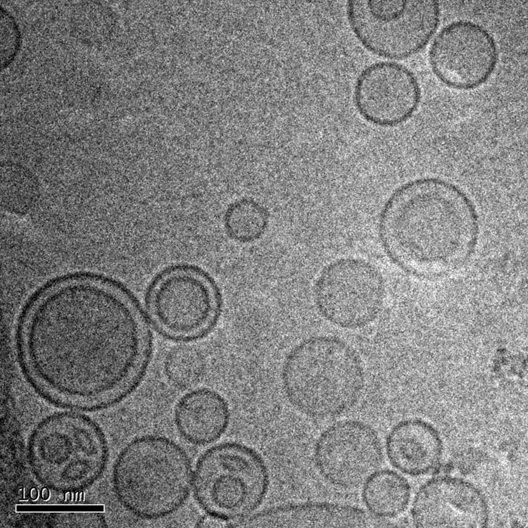 Figure 4 
                  Image taken by TEM from Nio-GGE. This image shows clearly two-layer structure of niosome and its spherical shape.
               