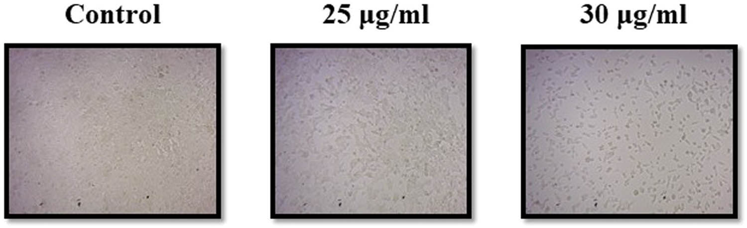 Figure 7 
                  Morphological alterations in HCT-116 cells treated with CuO NPs for 24 h.
               