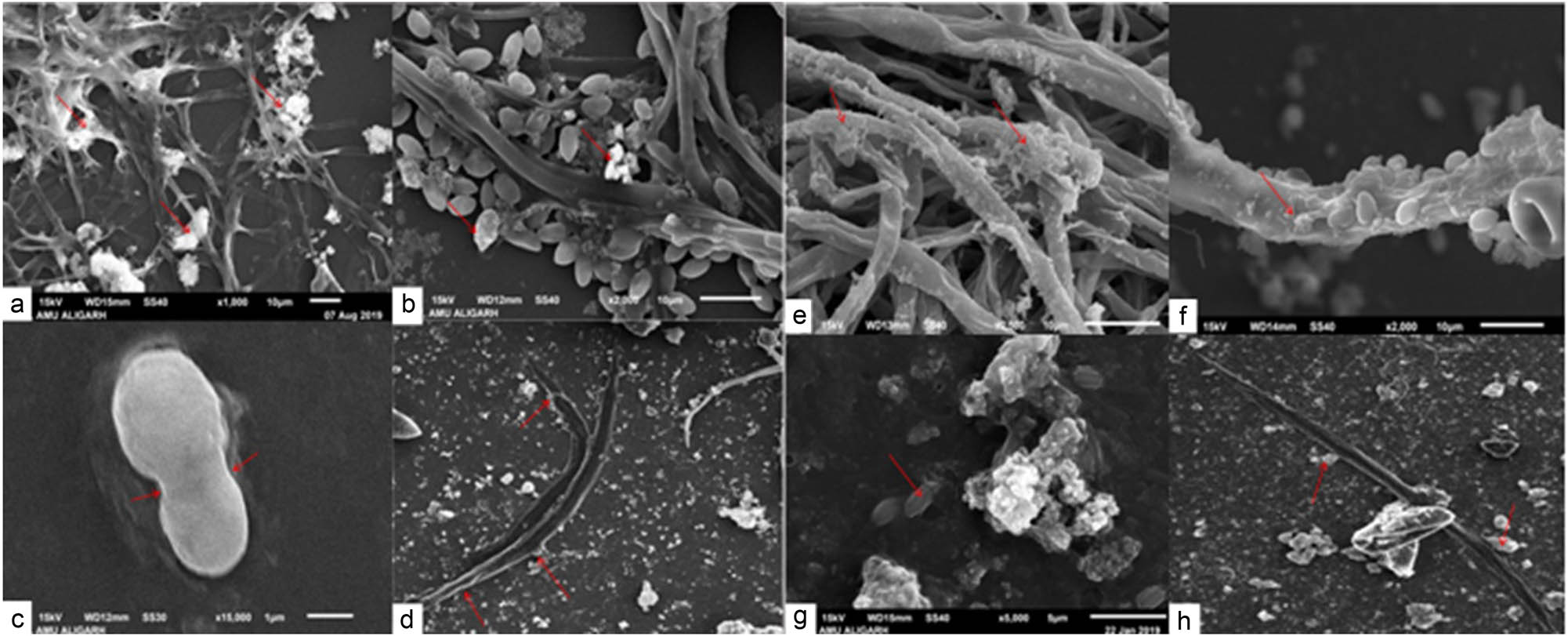 Figure 2
SEM images of test pathogens treated with SiO2-NPs and TiO2-NPs. (a and b) Mycelium and conidia of P. vexans sprayed with 0.20 mg/mL SiO2-NPs. (c) R. solanacearum handled with 0.20 mg/mL SiO2-NPs. (d) Nematode M. incognita handled with 0.20 mg/mL SiO2-NPs. (e and f) Mycelium and conidia of P. vexans handled with 0.20 mg/mL TiO2-NPs. (g) R. solanacearum treated with 0.20 mg/mL TiO2-NPs. (h) M. incognita J2 treated with 0.20 mg/mL TiO2-NPs.