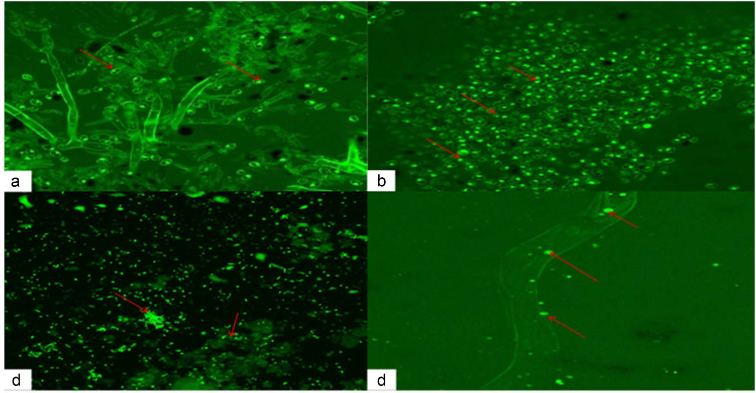 Figure 3
Confocal microscopic images of test pathogens: (a and b) penetration of SiO2-NPs in the mycelia and conidia of P. vexans; (c) SiO2-NPs attached with cells of R. solanacearum; and (d) penetration of SiO2-NPs in M. incognita J2.