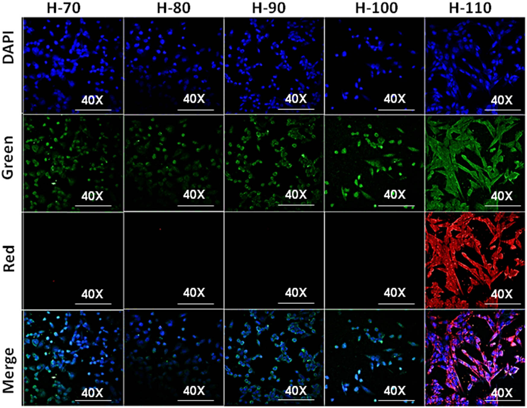 Figure 7 
                     Confocal imaging of cellular uptake of H-60, H-70, H-80, H-90, H-100, and H-110.
                  