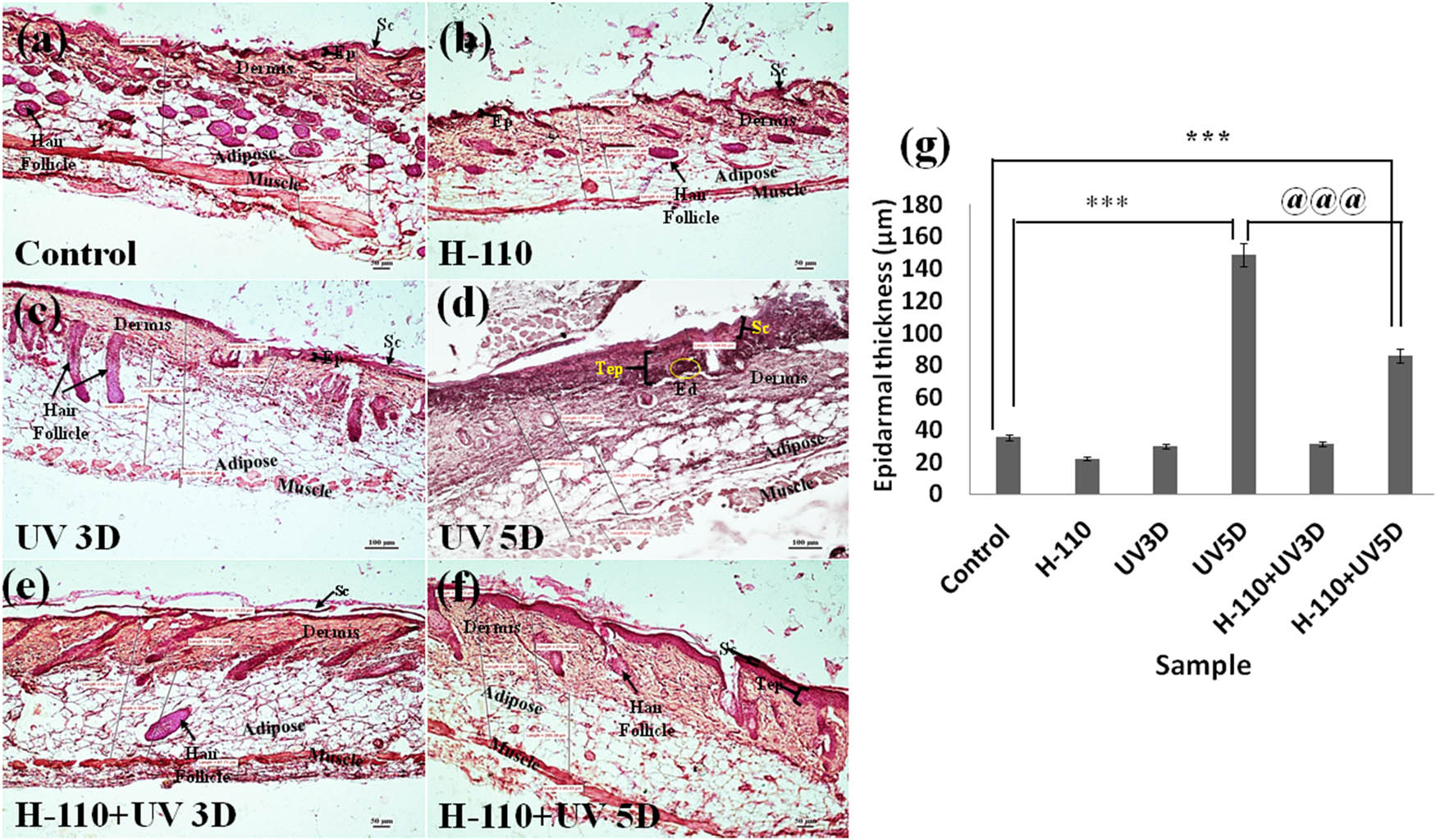 Figure 10 
                     Transverse section showing histoarchitecture of skin tissue of M. musculus: (a) control, (b) H-110 treated, (c) UVB treated for 3 days, (d) UVB treated for 5 days, (e) H-110 + UV treated for 3 days, and (f) H-110 + UV treated for 5 days; Ep represents epidermis, Sc represents stratum corneum, Tep represents thickening epidermis, and Ed represents edema. (g) The vertical bar represents the epidermal thickness of different treatment groups (mean ± SEM). Significance was tested using one-way ANOVA followed by Tukey post-hoc test. The symbol * shows the significance level between control and only UVB 5 days, # shows the significance level between control and H-110 + UVB 5 days, and @ shows the significance level between only UVB 5 days and H-110 + UVB 5 days. Data were considered statistically significant as ***/###/@@@ for P < 0.0001.
                  