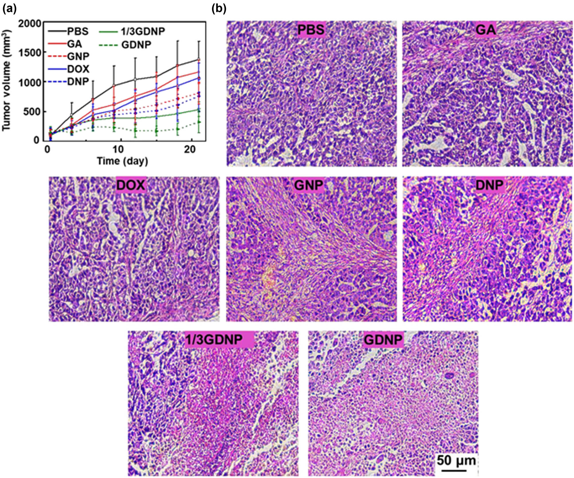 Figure 8 
                     
                        In vivo demonstration of the antitumor efficiency of the drug-encapsulated bionanomaterials: (a) Free DOX and GA slightly inhibited the tumor growth as compared with the control treatment; (b) in a comparative assessment, larger necrotic regions were observed for the DNP and GNP groups than those of the free drugs. Meanwhile, the combined treatment with GDNP (combination of DNP and GNP) and 1/3 GDNP produced enhanced necrosis regions, which resulted in ≈ 90% induced apoptosis of cancer cells. Reproduced from ref. [134], Copyright 2020, Elsevier Science Ltd.
                  