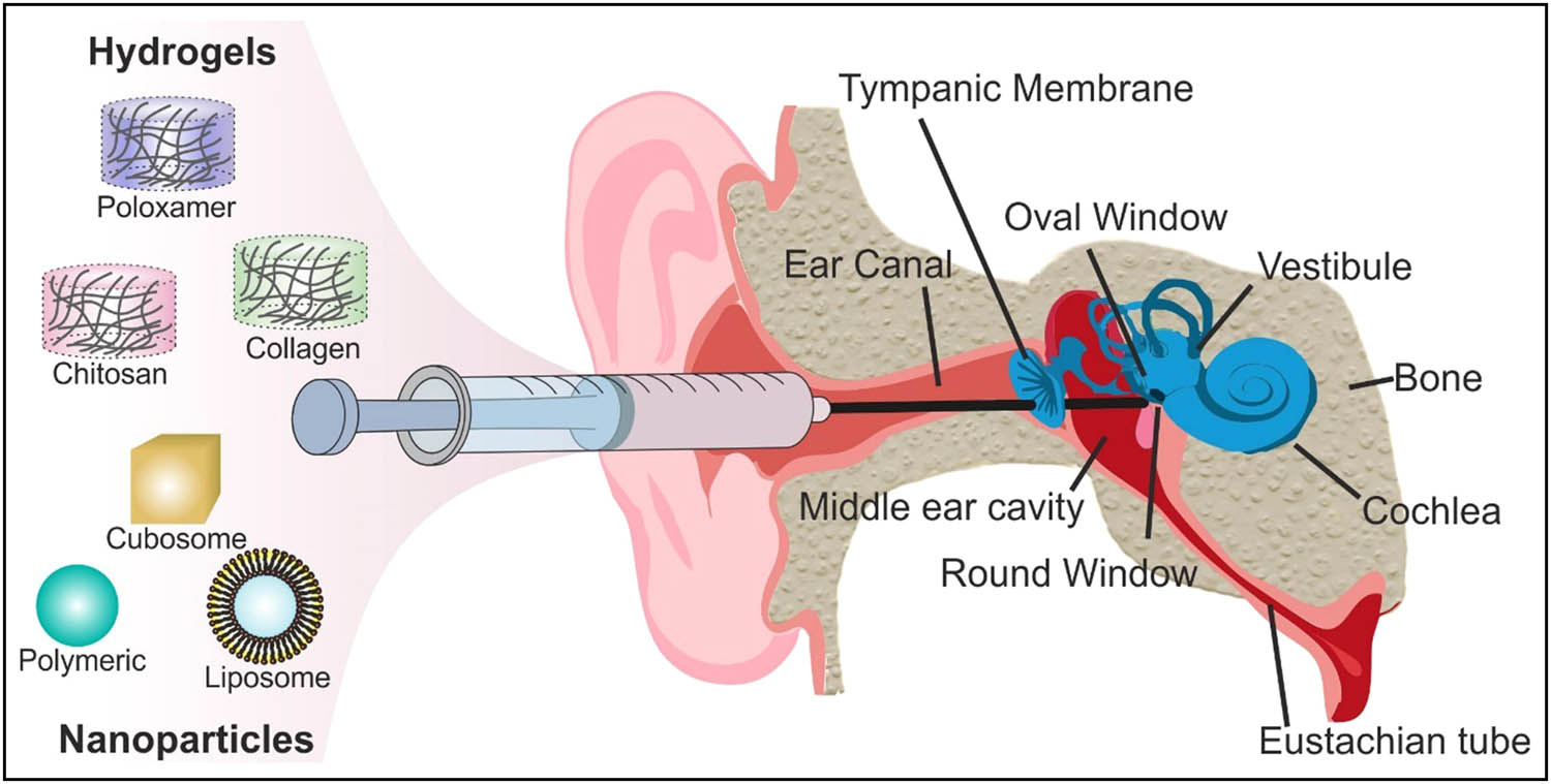 Figure 8 
                  Representation of various injectable nanobiomaterial drug delivery systems to the inner ear [95]. Reproduced with permission from ref. [95], 2019 © Creative Commons CC BY 4.0.
               