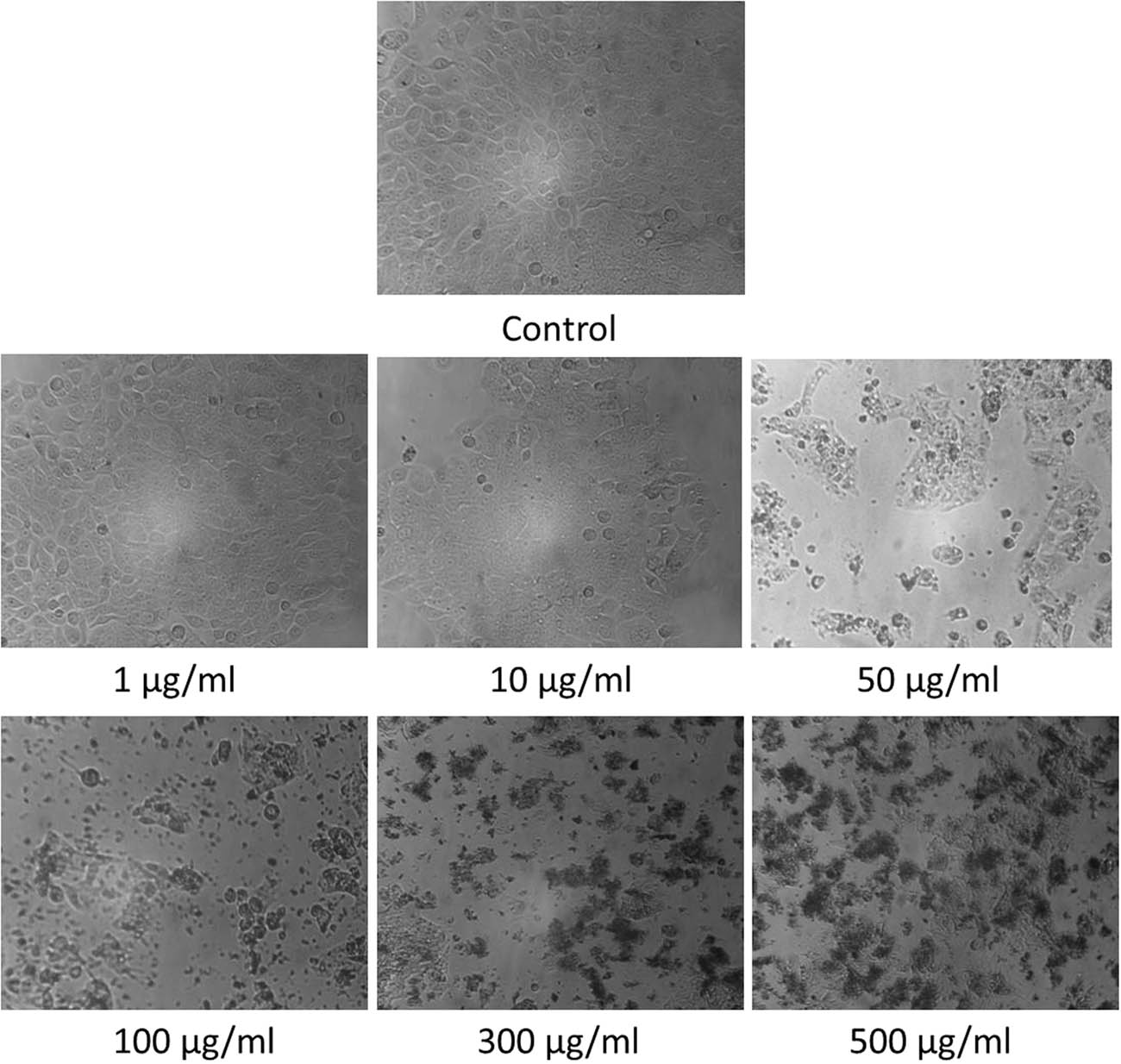 Figure 6 
                  Microscopic observations on HT-29 cells after treatment with AgNPs at various concentrations.
               