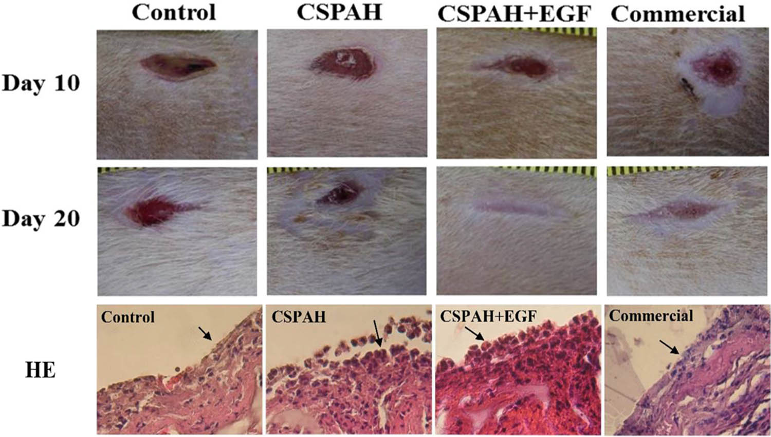Figure 4 
                  Representative images and HE staining results of wound surface healing over time in CSPAH, CSPAH-incorporating EGF, commercial dressings, and the control at days 10 and 20. HEMA: hydroxyethyl methacrylate; CSPAH: chitosan-PAA-pHEMA; EGF: epidermal growth factor; PAA: poly(acrylic acid) [103].
               