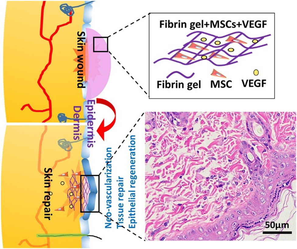 Figure 7 
                  Schematic diagram of biofunctionalized fibrin gel co-embedded with BMSCs and VEGF for accelerating skin injury repair [155].
               