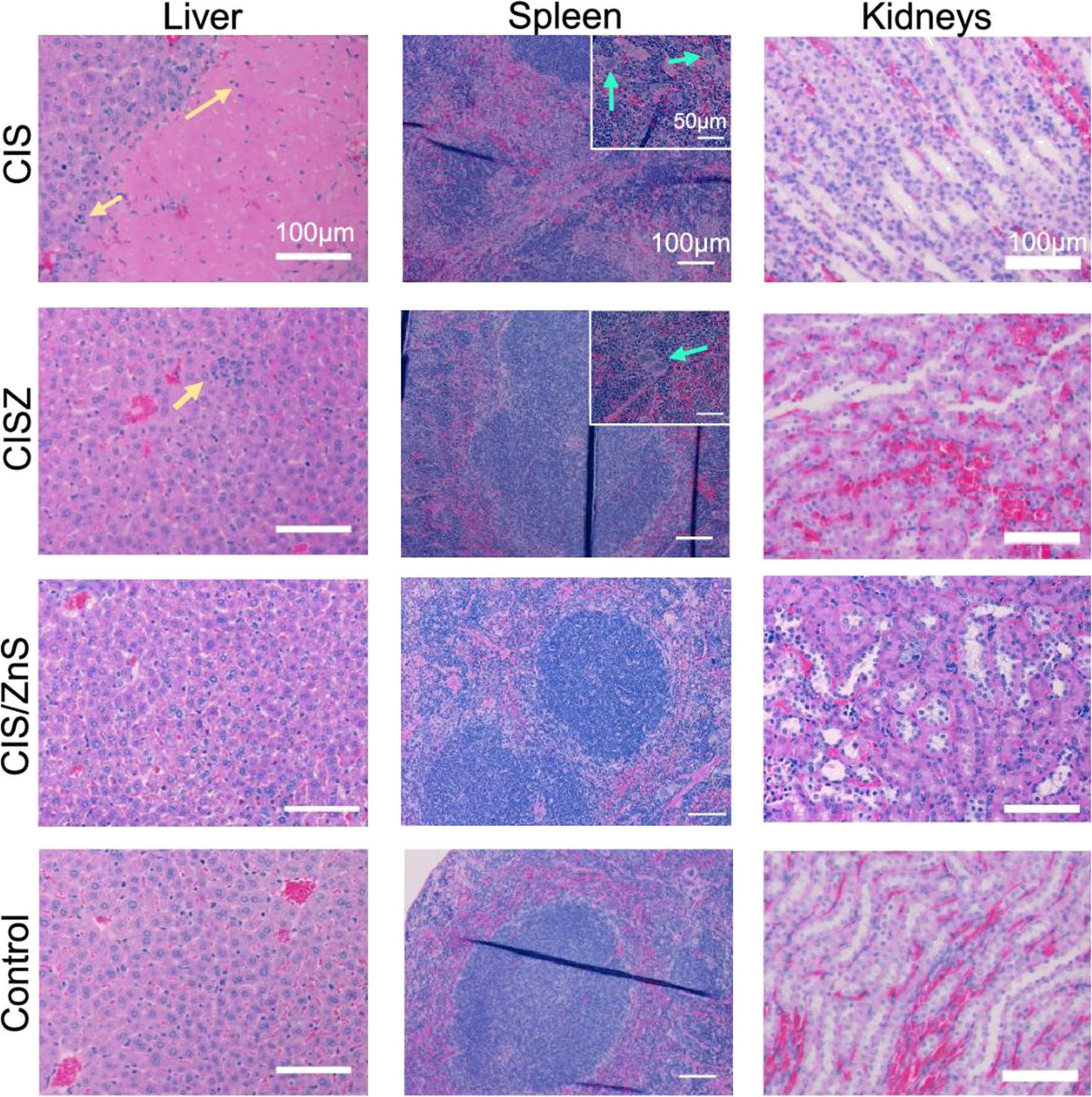 Figure 8 
               Micrograph of the organs (liver, spleen, and kidney) in the histopathological studies of QDs-dosed mice. The yellow arrow shows the inflammatory cells, while the blue arrow shows the multinucleated cells; with permission from ref. [129]; ACS.
            