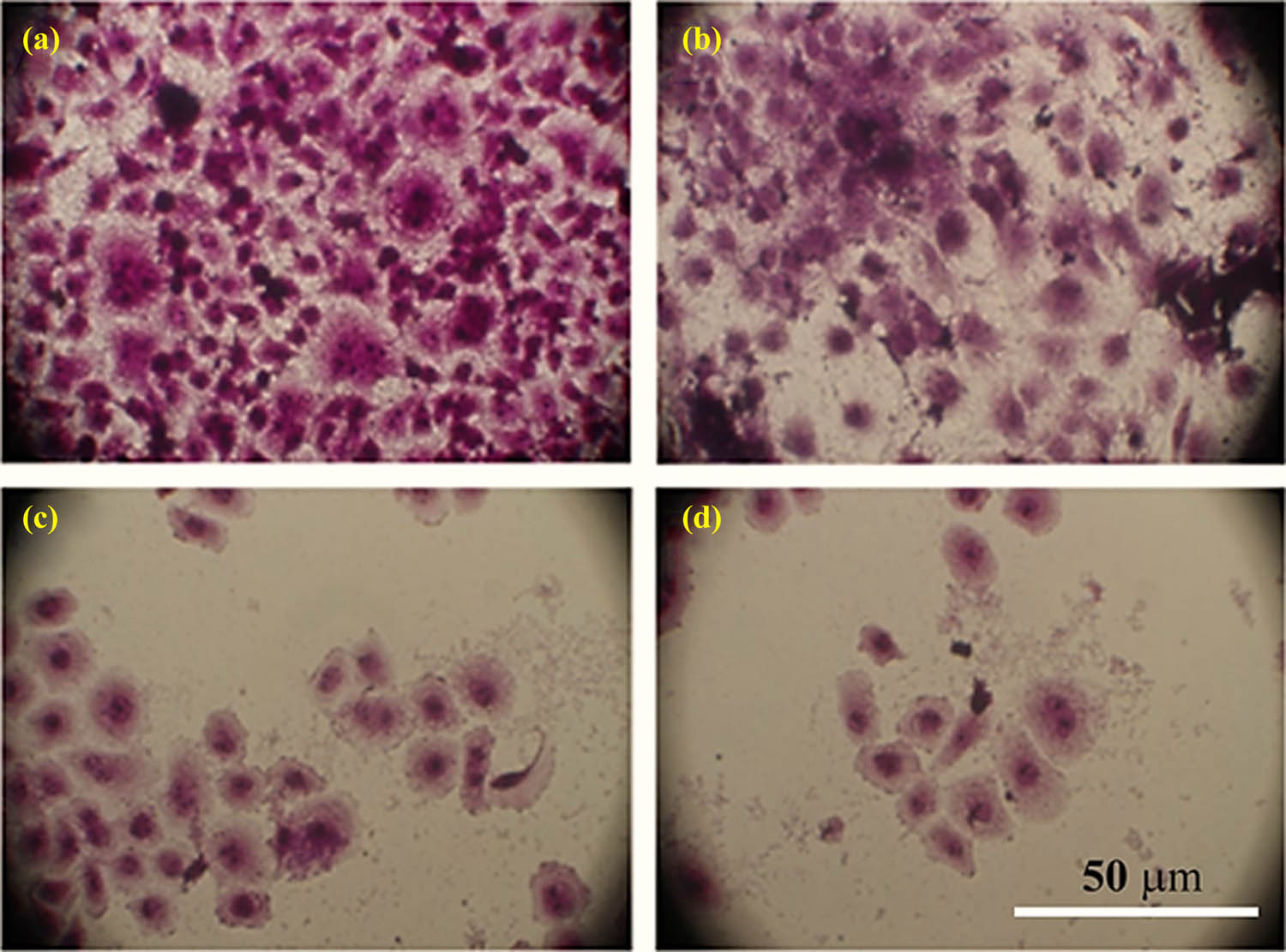 Figure 9 
                  Morphological changes: changes in AMJ13 cell lines stained with crystal violet dye after treatment with CHR, AuNPs, and CHR–AuNPs: (a) non-treated control cells, (b) CHR-treated cells, (c) AuNPs-treated cells, and (d) CHR–AuNPs-treated cells.
               