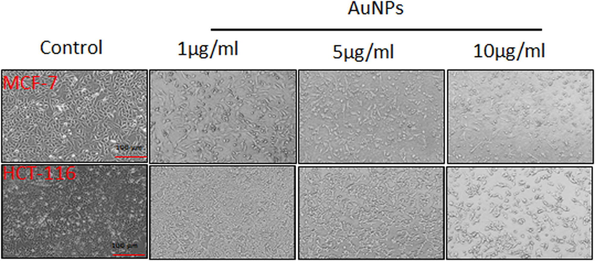 Figure 3 
                  MCF-7 and HCT-116 cells were treated with increasing concentrations of AuNPs for 24 h and showed morphological alterations. The images were captured using a Leica microscope at 10× magnification.
               