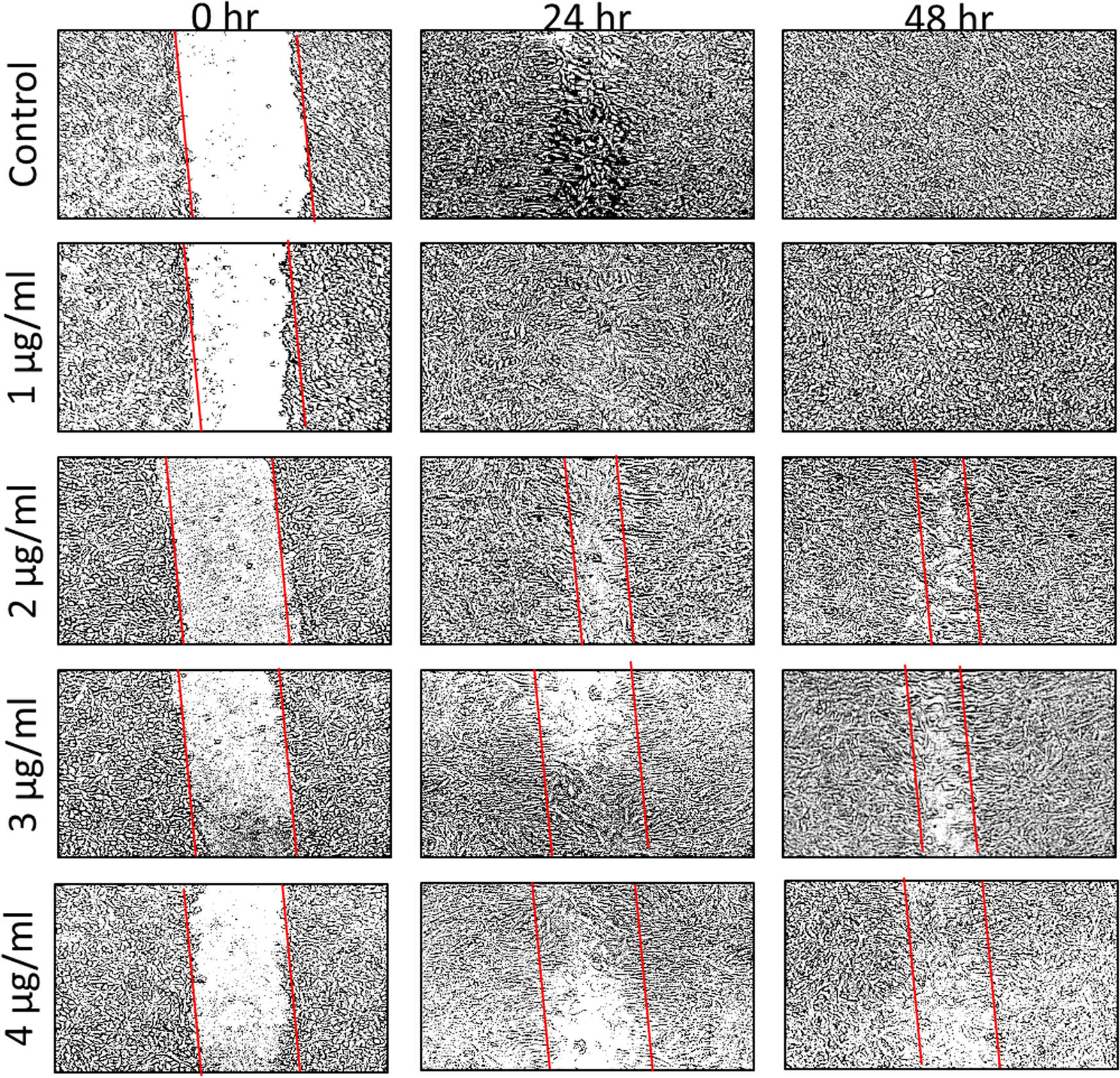 Figure 4 
                  Scratch was applied to a monolayer of cells, which was then treated with 1–4 µg/mL AuNPs at various time intervals (0, 24, and 48 h). The number of cells that migrated to the scratch area, indicating metastatic inhibition, is visually displayed by outlining the scratch with parallel lines and visually exhibiting the number of cells that migrated to the scratch area.
               