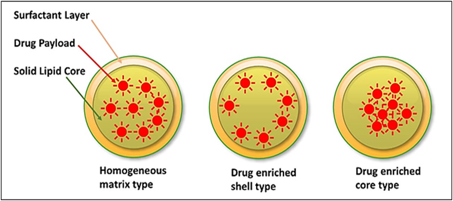 Figure 8 
               SLNs drug loading models showing homogenous matrix, drug-enriched peripheral-shell, and drug-enriched core shell models.
            