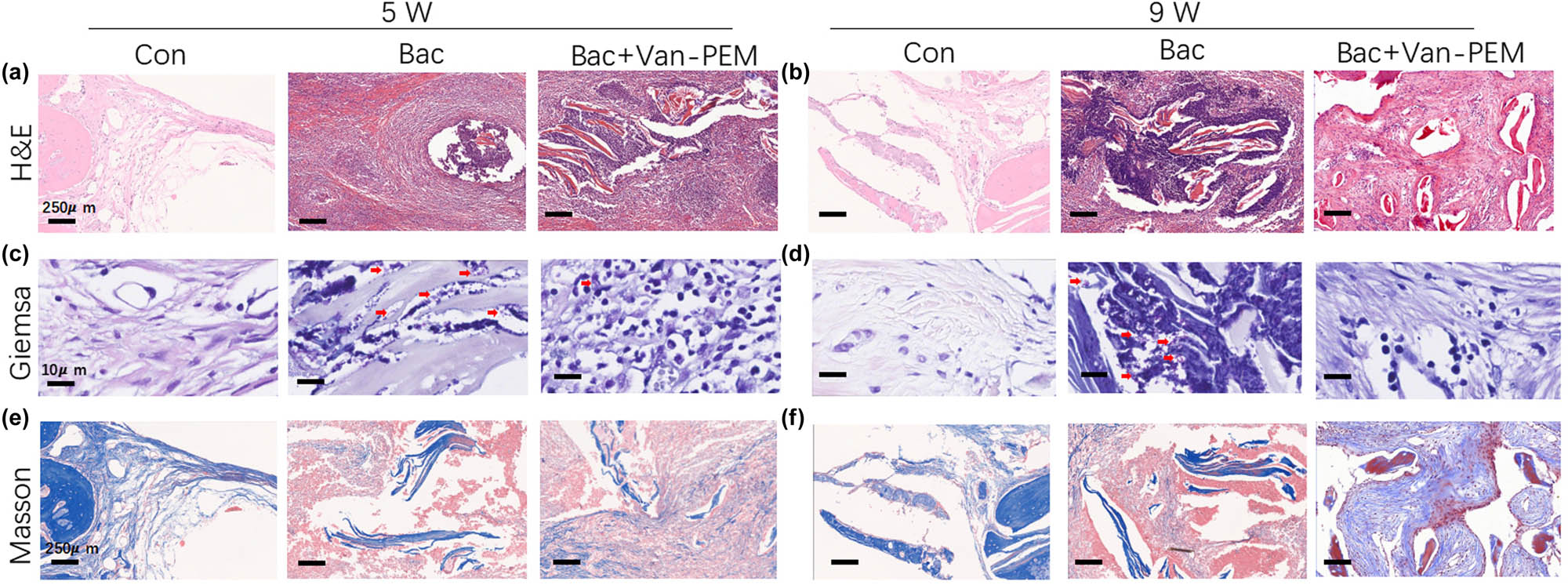 Figure 8 
                  (a and b) H&E staining of the skull wounds in the control, bacteria-treated, and Van-PEM groups at weeks 5 and 9. Van-PEM hydrogel treatment can significantly reduce the inflammatory response. (c and d) Giemsa staining of each group at the same time points. Van-PEM hydrogel can reduce the number of bacteria in the bone defect site. Red arrows indicate bacteria hidden in tissue. (e and f) Masson staining of each group at the same time points. Van-PEM hydrogel treatment promotes collagen formation.
               