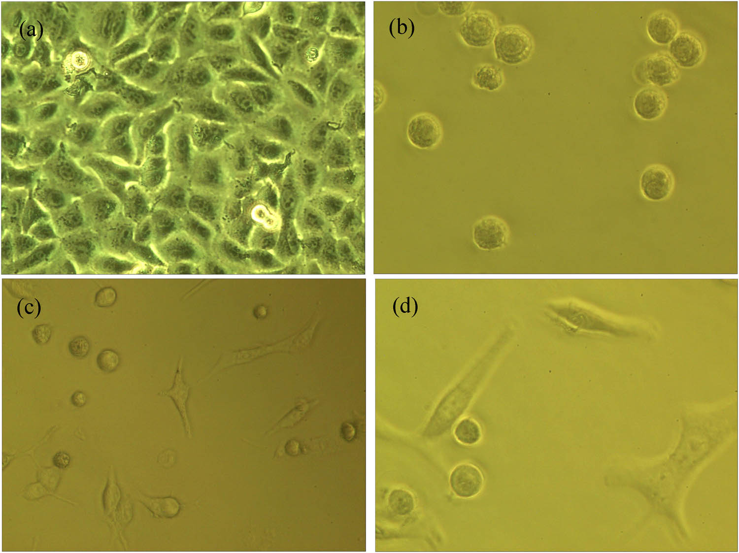 Figure 8 
                     The morphology of human lung cancer A549 cell line in the light microscope (×800) after the MF hyperthermia: (a) control group and (b)–(d) experimental group with 55 mg/mL at 300 A.
                  
