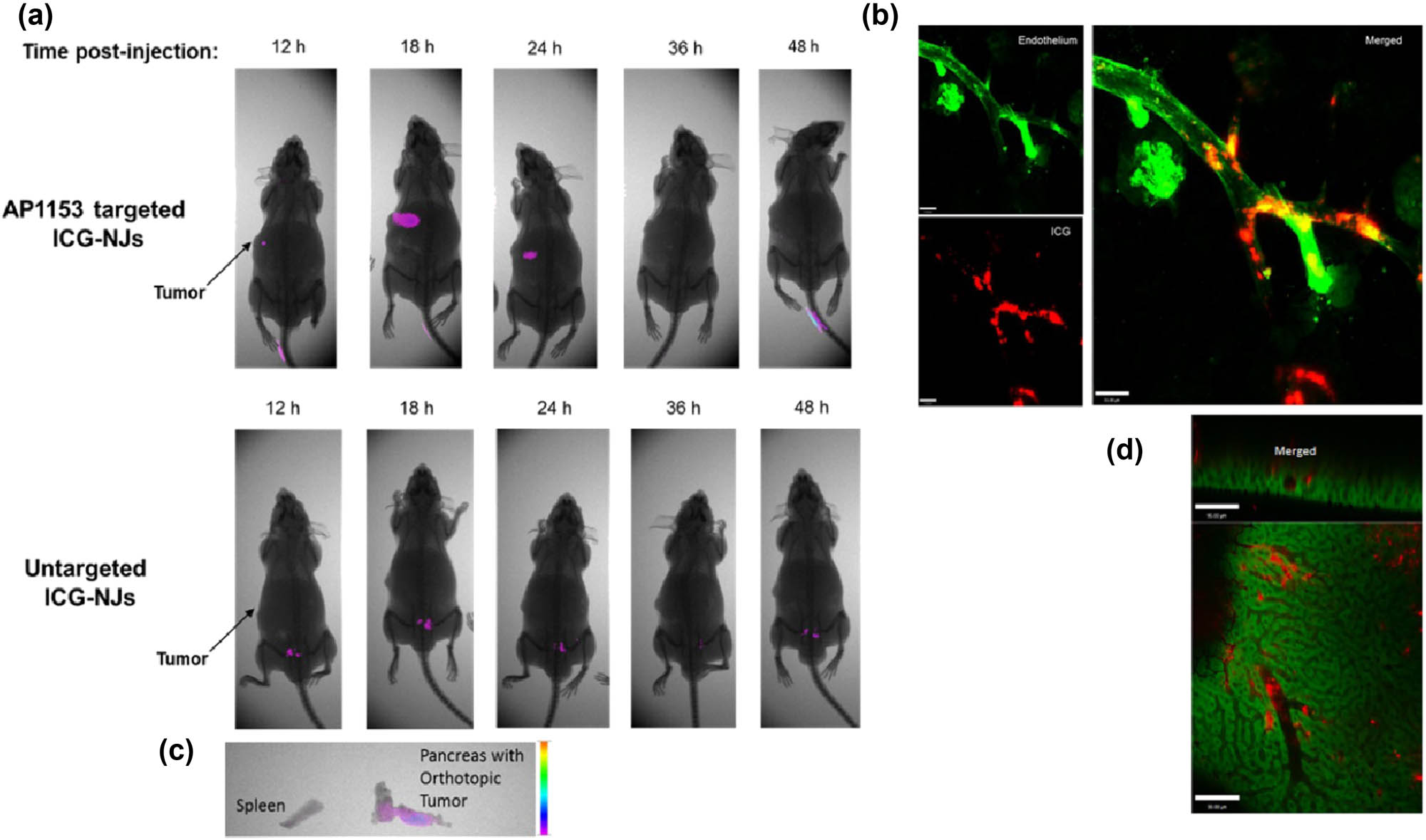 Figure 6 
                  (a) NIR optical imaging of PANC-1 tumor-bearing mice after injection of non-targeted ICG-NJs and aptamer AP1153-targeted ICG-NJS, respectively. The arrow indicates the position of the PANC-1 tumor in situ. (b) In vitro NIR imaging of resected tissues from the pancreas and spleen of mice treated with AP1153-ICG-NJ. (c) Renal and (d) liver tissue sections from mice injected with AP1153-ICG-NJ shows that although there were some ICG signals (red) in the tissue vasculature (green), there seemed to be no ICG aggregation in the normal cells of these organs. Reproduced with permission from ref. [31], Copyright 2021, DMP.
               