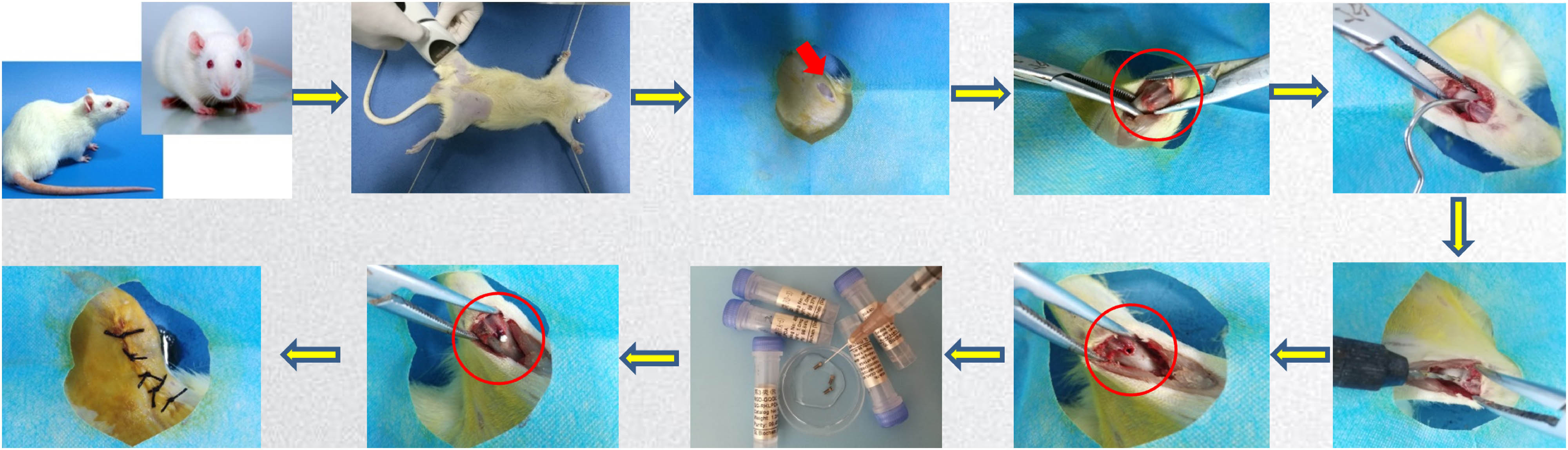 Figure 1 
                  Procedure of implantation surgery.
               
