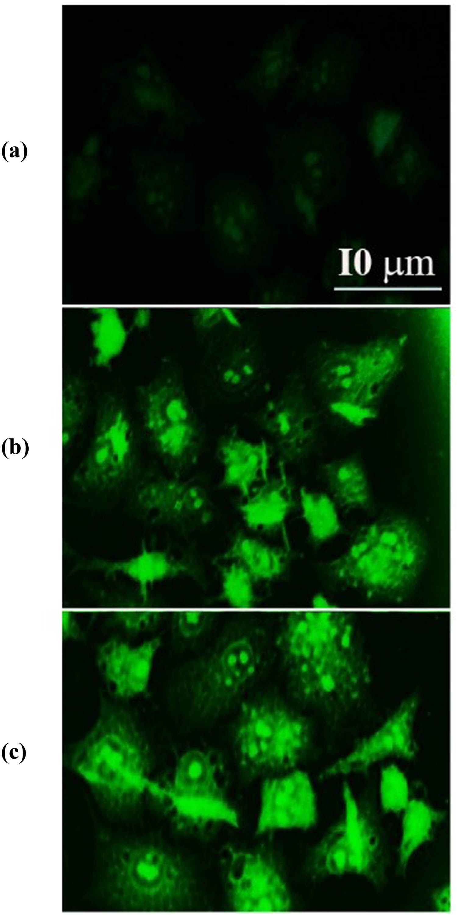Figure 10 
                  SWCNTs and SWCNTs@Ag–TiO2 induce annexin 1A protein in Hep-G2 cancer cells. (a) Control untreated cells. (b) SWCNT-exposed cells. (c) SWCNTs@Ag–TiO2-exposed cells.
               