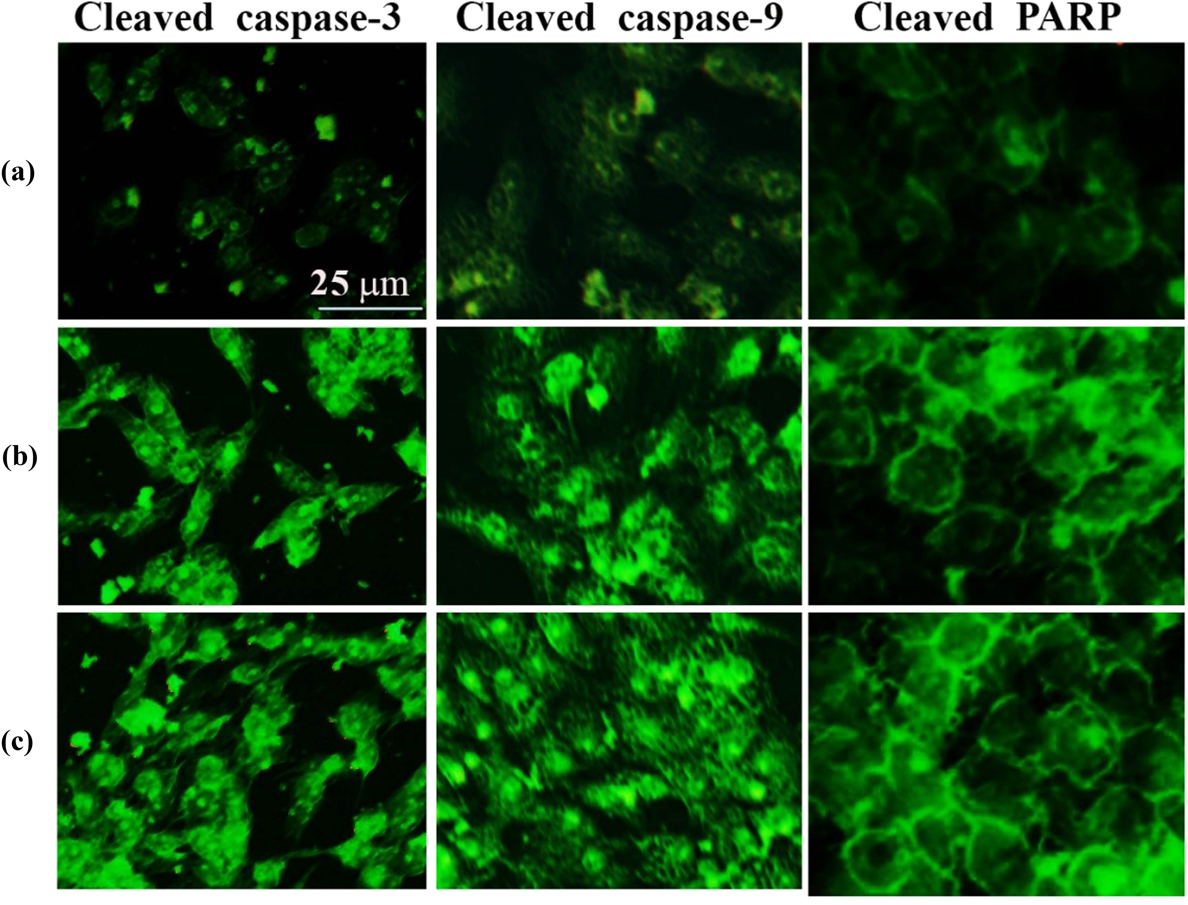 Figure 11 
                  SWCNTs and SWCNTs@Ag–TiO2 induce apoptotic proteins’ expression: cleaved-caspase-3, cleaved-caspase-9, and cleaved-PARP in Hep-G2 cancer cells. (a) Control untreated cells. (b) SWCNTs-exposed cells. (c) SWCNTs@Ag–TiO2-exposed cells.
               