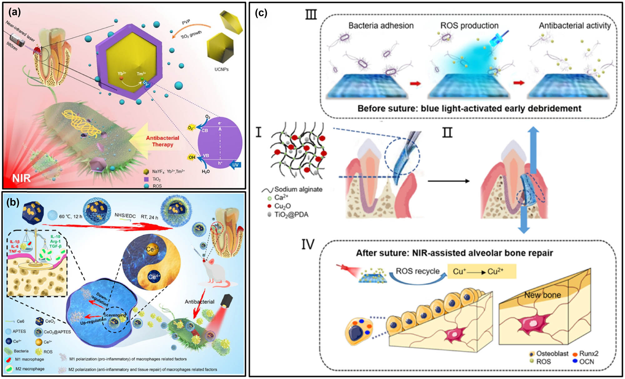 Figure 4 
                  Nanotechnology-enhanced PDT for the treatment of periodontitis. (a) To combat periodontitis-related pathogens, TiO2-loaded core–shell structure UPNPs were used for inducing PDT under NIR light [84]. Copyright 2021, Elsevier. (b) Ce6-CeO2-NP was formed by decorating Ce6 onto the surface of CeO2 nanoparticles, allowing CeO2 to absorb excessive ROS produced by Ce6. This nanosystem can eliminate pathogens while preventing inflammation caused by excessive ROS. Reproduced with permission from Sun et al. [87]. Copyright 2021, Elsevier. (c) A guided tissue regeneration membrane was formed by mixing sodium alginate hydrogel, TiO2-NP-PDA, and Cu2O. This membrane exhibits both antibacterial properties and the ability to repair alveolar bone in the treatment of periodontitis. Reproduced with permission from Xu et al. [89]. Copyright 2020, American Chemical Society.
               