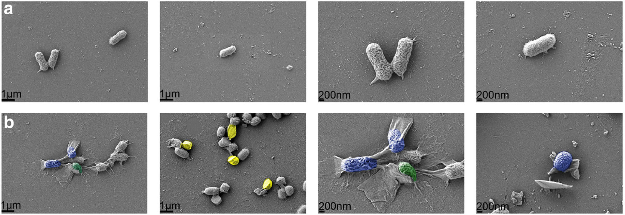 Figure 14 
                     Scanning electron microscopy of Escherichia coli cell treated (a) without nanocomposite and (b) with GO suspensions. Reproduced with permission from references [192].
                  