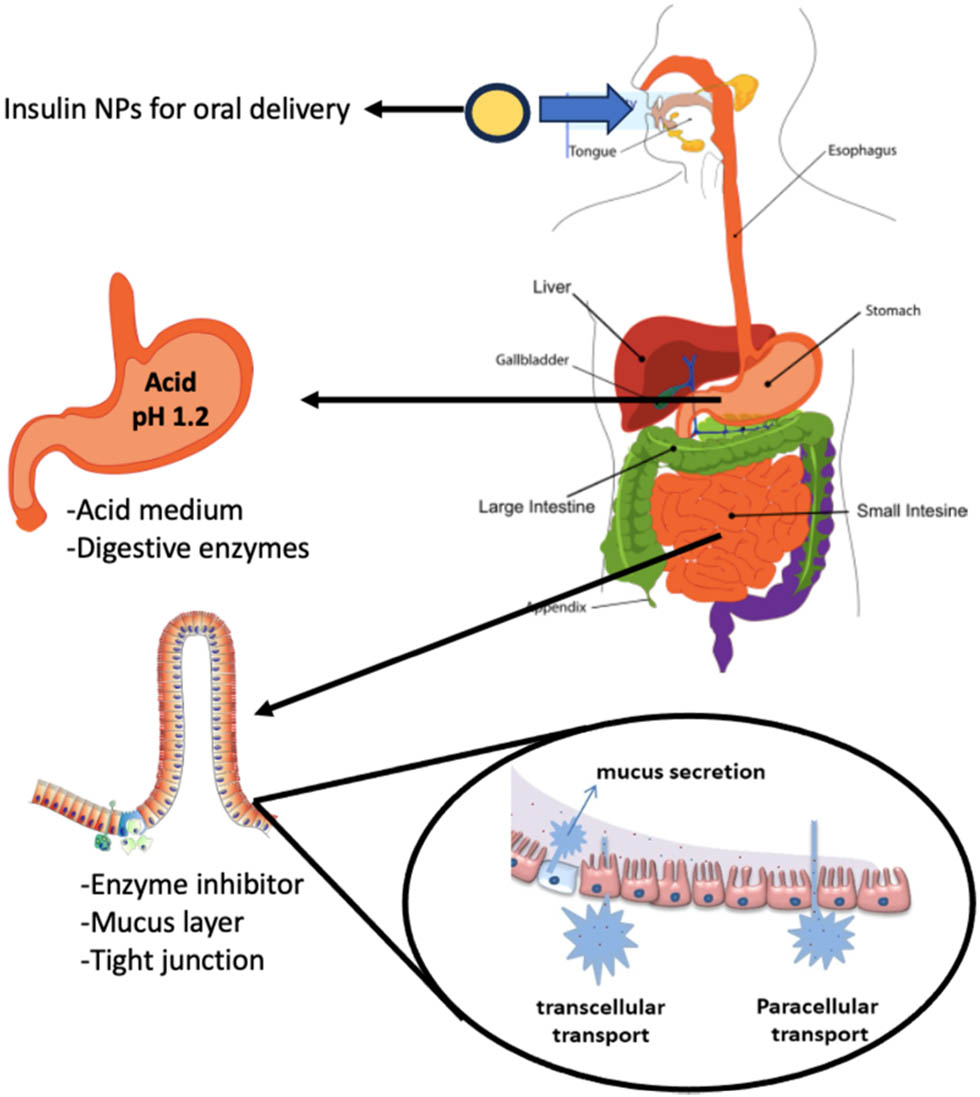 Figure 3 
                  The GI barriers for OID.
               