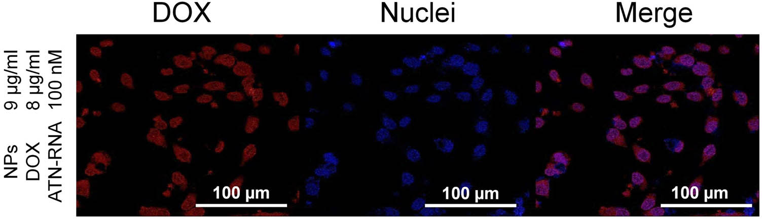 Figure 7 
                  Confocal laser scanning microscopy images demonstrating the presence of DOX delivered by NPs in U-118 MG cells. Imaging was conducted after 4 h of incubation with PDA@DD3.0@DOX@ATN-RNA at a concentration of 9 µg/mL. Hoechst 33342 staining for nuclei (blue); DOX (red).
               