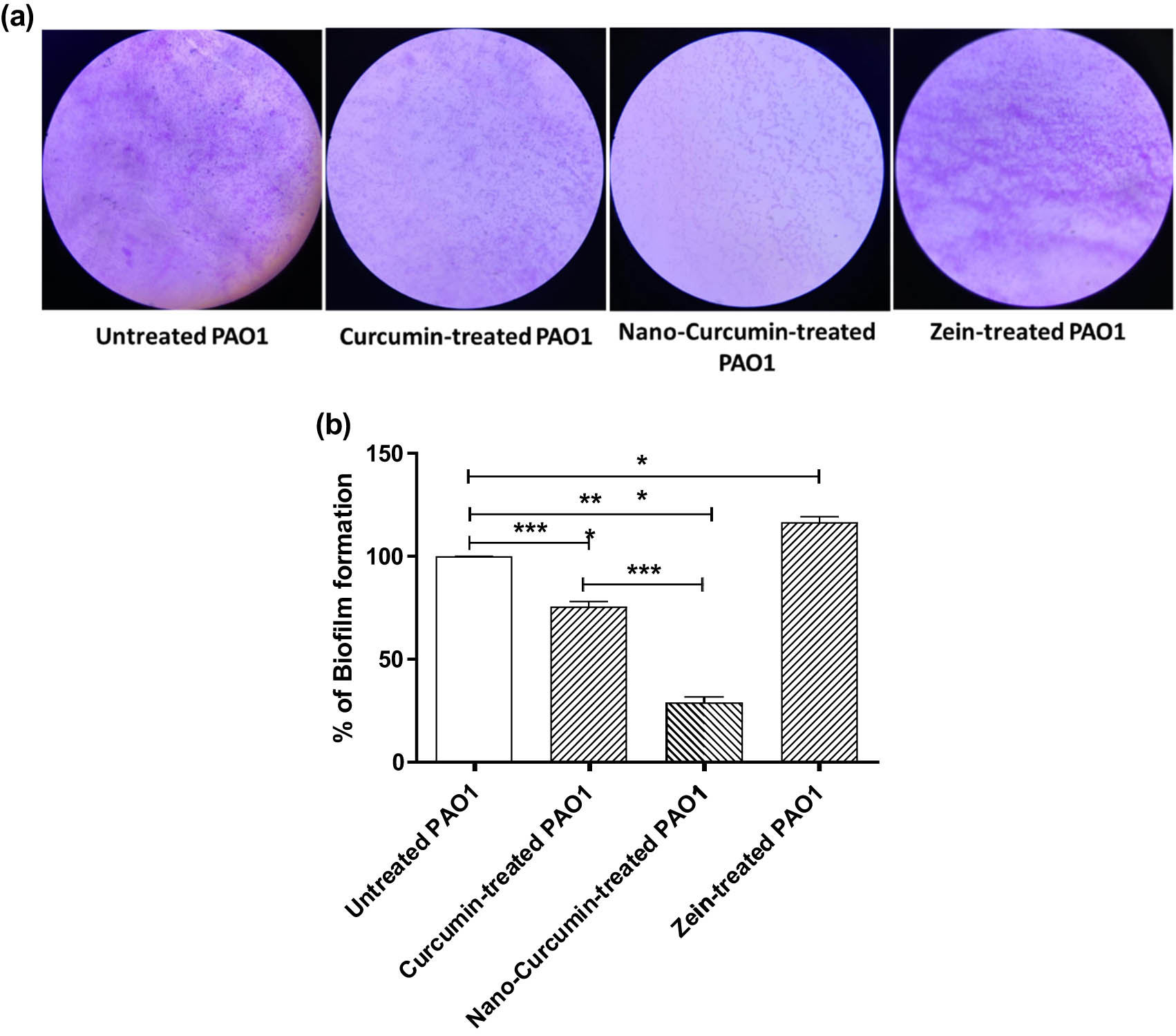 Figure 2 
                  Curcumin in nanoformulation acquires significant antibiofilm activity. The biofilm formation in the presence of curcumin alone and nanoformulation was compared to that formed with untreated bacteria and zein-treated bacteria using the crystal violet method at sub-MIC concentrations to exclude any influence on the growth. (a) Representative light microscope images for the effect on biofilm formation. Curcumin alone or in nanoformulation (at sub-MIC) obviously decreased the biofilm formation in comparison to biofilm formed by untreated P. aeruginosa PAO1. On the other hand, zein increased the biofilm formation markedly in comparison to untreated bacteria. (b) Quantification of biofilm formation. However, zein increased the biofilm formation significantly compared to untreated bacteria, while curcumin diminished significantly the biofilm formation. The most significant reduction in biofilm formation was observed with curcumin in nanoformulation (about 70%) than the curcumin effect alone (about 24%). **p < 0.01; ***p < 0.001.
               