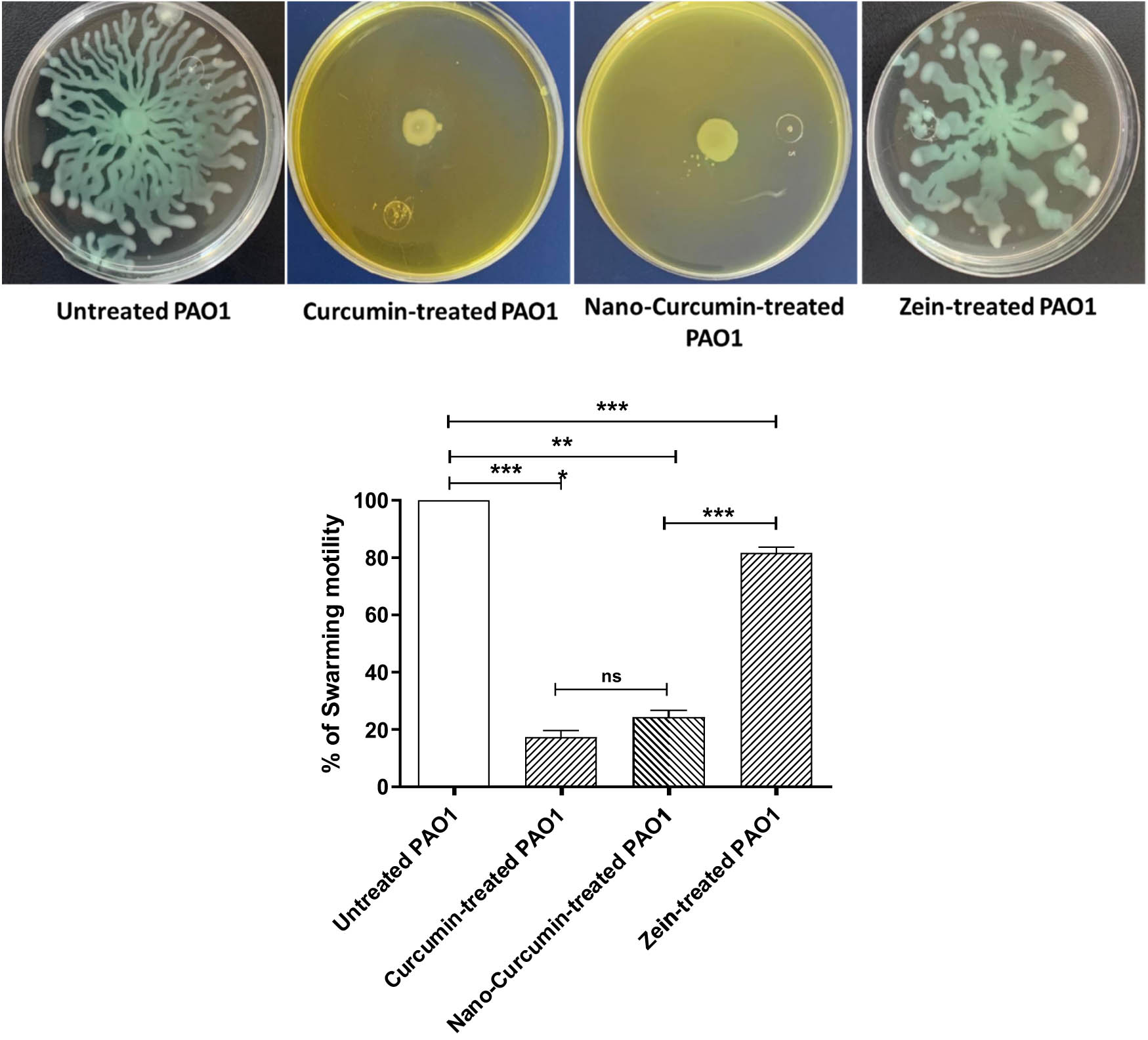 Figure 3 
                  Curcumin reduces bacterial motility. The swarming zone of P. aeruginosa PAO1 was measured on plates provided with or without curcumin, curcumin nanoformulated, and zein at sub-MIC. However, zein significantly reduced the motility as compared to control untreated bacteria, curcumin alone, or curcumin nanoformulated and significantly reduced the motility as compared to zein-treated bacteria or untreated bacteria. There was no significant difference between the inhibitory effect of curcumin or curcumin in nanoformula on motility. Non-significant (ns): p > 0.05; ***p < 0.001.
               
