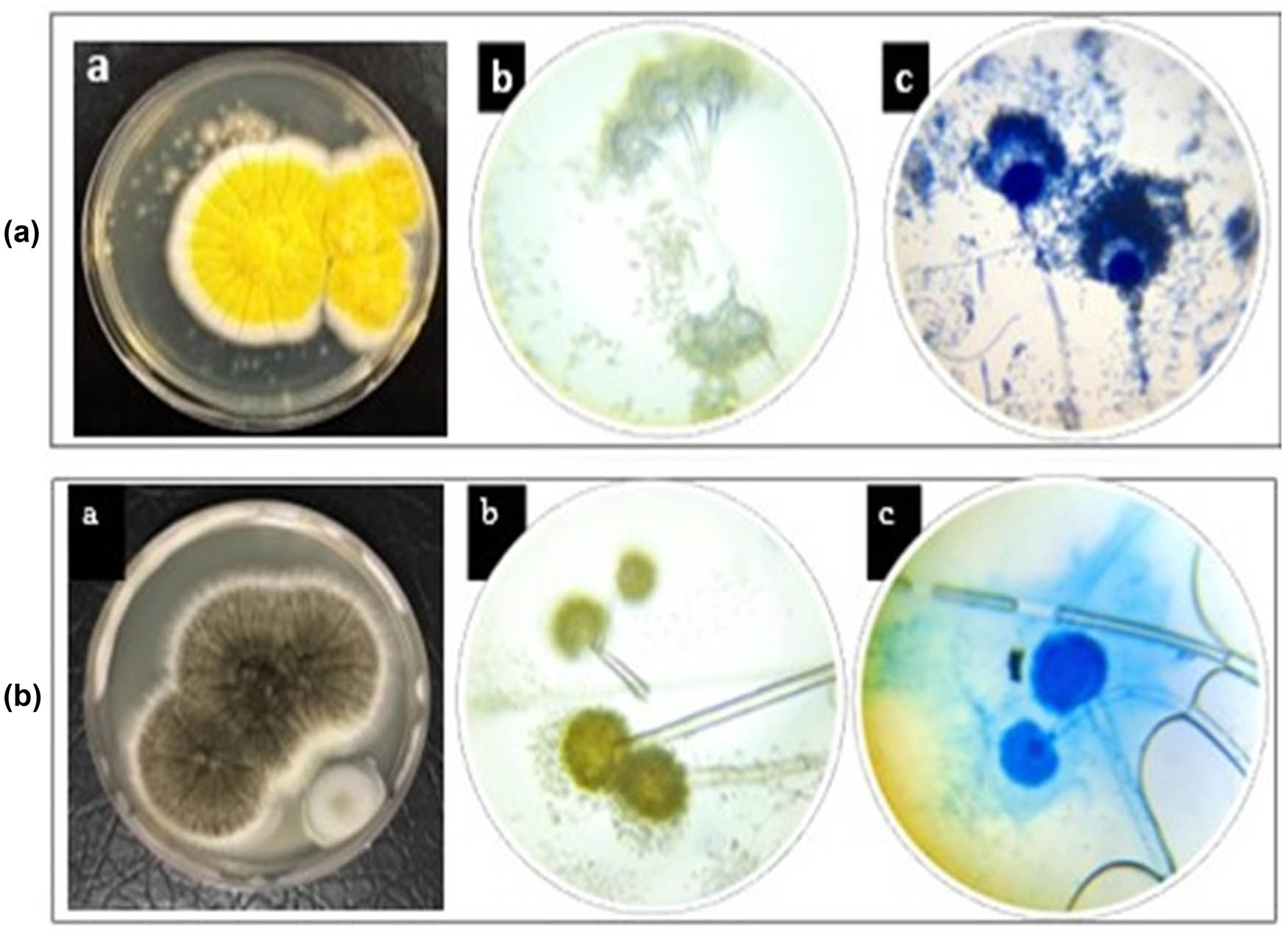 Figure 2 
                  Phenotypic identification by optical microscopy of M. guilliermondii (a) and A. welwitschiae (b): ((a) colonial morphology; (b) cellular morphology without staining; (c) cellular morphology with India-ink staining. Magnification ×40).
               