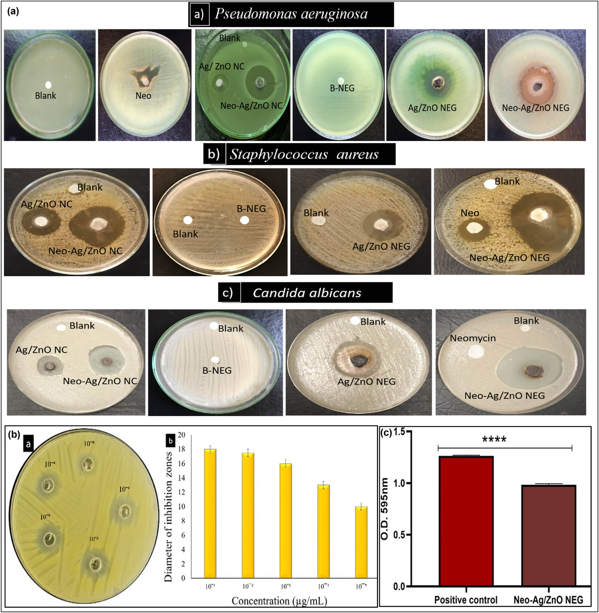 Figure 6 
                  (a) Antimicrobial activity of samples against ((a) P. aeruginosa, (b) S. aureus, and (c) C. albicans). (b) MIC of Neo-Ag/ZnO NEG against MRSA: ((a) agar well diffusion plate and (b) graphical representation). (c) Antibiofilm activity of Neo-Ag/ZnO NEG against MRSA. Positive control: untreated microorganisms. Neo: neomycin; NC: ananocomposite; B-NEG: Blank NEG; NEG: nanoemulgel; Ag/ZnO: silver/zinc oxide.
               