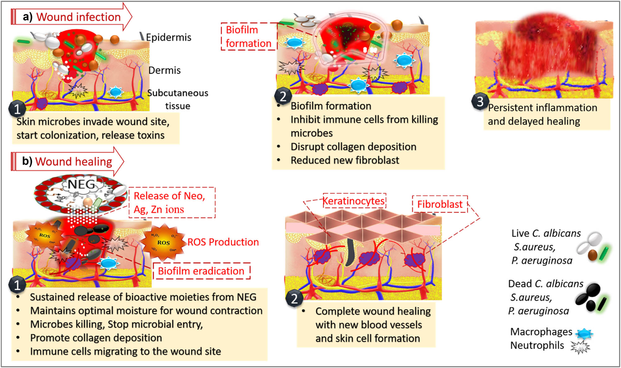 Figure 8 
                  Illustration of putative skin wound infection mechanism by microbes (a). Neo-Ag/ZnO NEG-induced wound healing mechanisms (b).
               