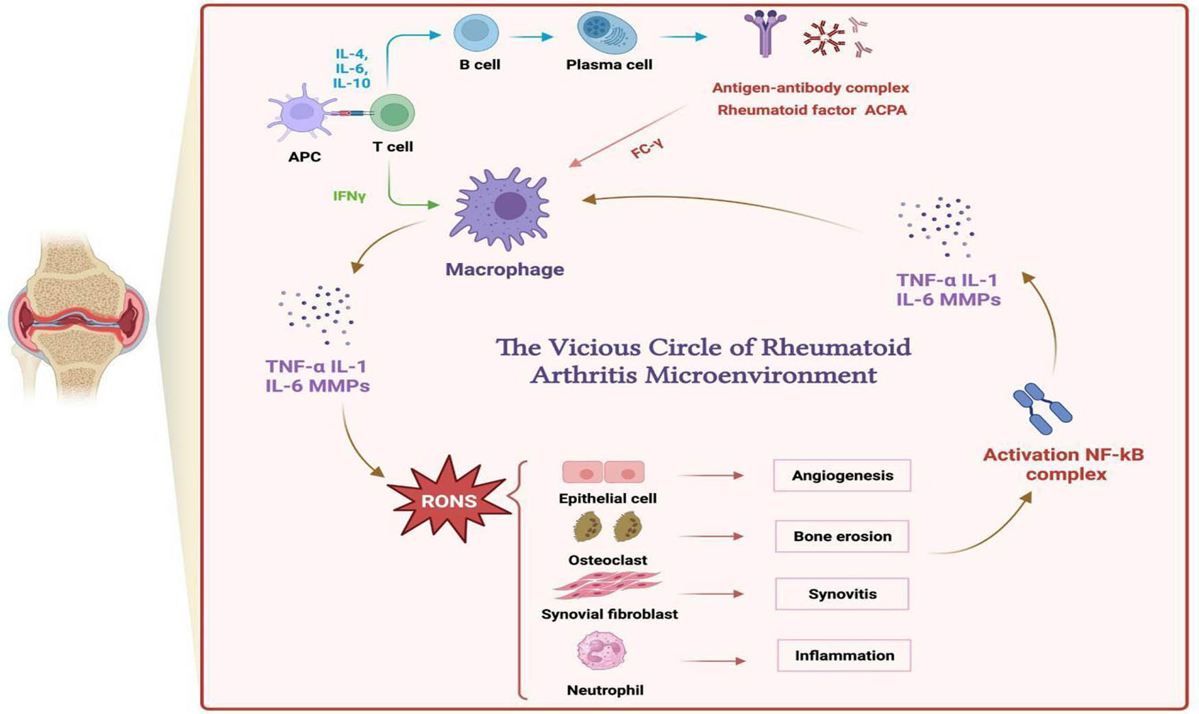 Figure 2
Effect of RONS in inflamed joints and the vicious circle of RA.