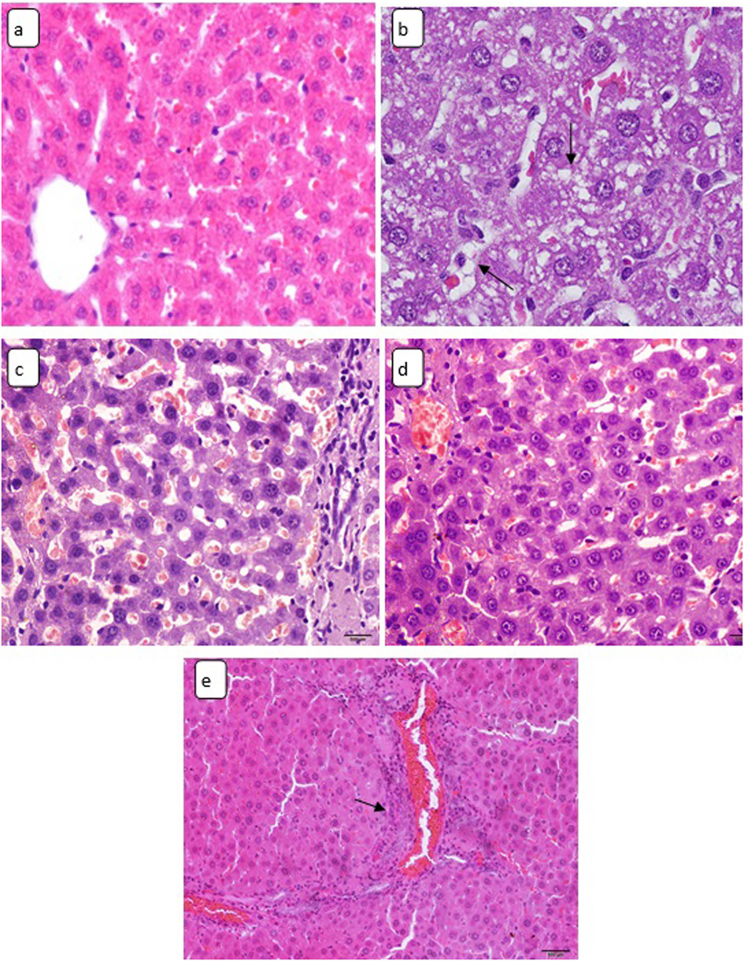 Figure 4
Light micrographs of hepatic tissue stained by H&E stain showing (a) control rat liver, ×180. Sections in the hepatic tissue of CuO NPs-treated animals demonstrating: (b) hydropic degeneration (arrows), ×400; (c) sinusoidal dilatation, ×180; (d) Kupffer cells enlargement, ×180; and (e) inflammatory cells infiltration (arrow), ×128.