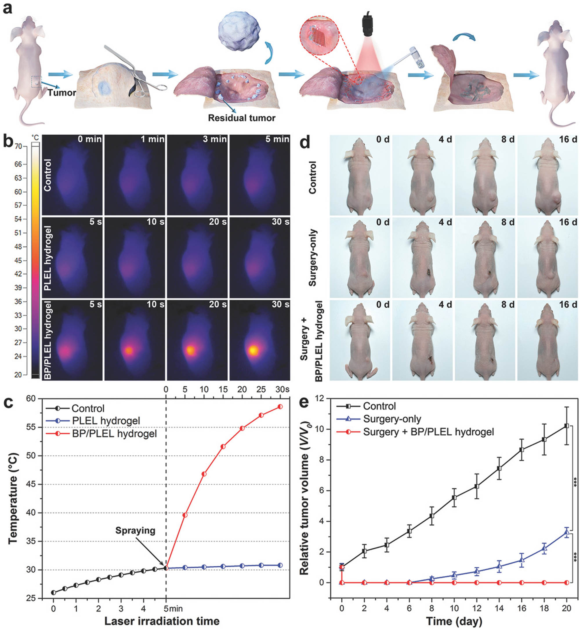 Figure 8 
                  PTT for postoperative treatment of tumors. (a) The hydrogel was applied for PTT to eliminate residual tumor tissue after tumor resection surgery. (b) Infrared thermographic maps. (c) The temperature in the tumor-bearing nude mice gradually rose with time following the application by spraying, via a skin incision, of poly(lactide)-poly(ethylene glycol)-poly(lactide) (PLEL) and BP@PLEL hydrogel, coupled with irradiation using an 808-nm laser at 0.5 W/cm2. (d) Representative images and (e) corresponding growth curves depicting tumor-bearing mice subjected to various treatments: no treatment, surgical intervention alone, and surgical intervention followed by PTT. Reproduced with permission [160]. Copyright © 2018, Wiley.
               