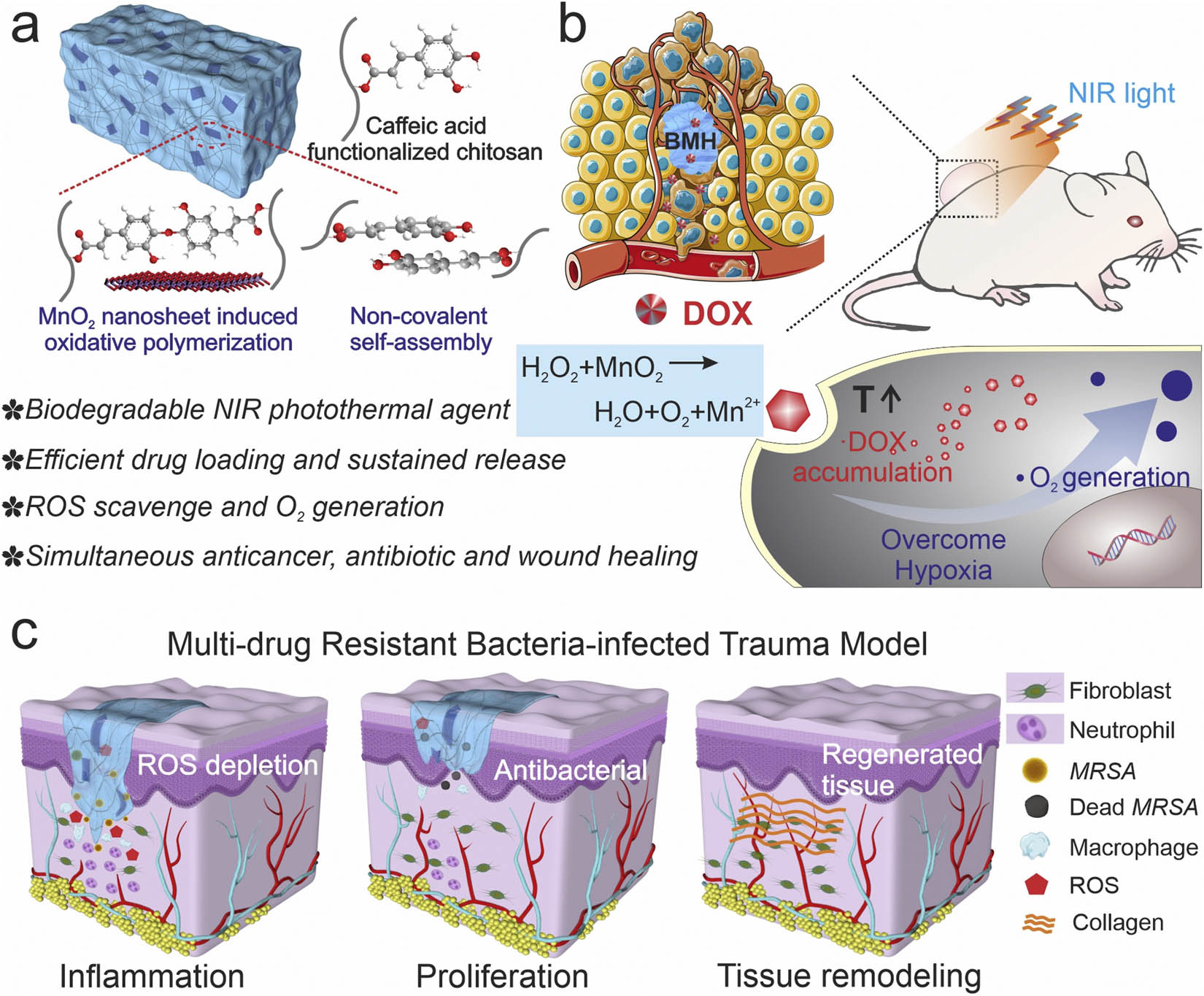 Figure 10 
                  Schematic illustration of MnO2/CS hybrid hydrogel for effective melanoma treatment and methicillin-resistant S. aureus-infected wound healing. (a) 3D illustration of the hydrogel showing the composition and structure and its advantages in simultaneous anticancer therapy and wound closure of multidrug resistance bacterial infection. (b) The hydrogel synergistically enhanced chemotherapy by decomposing endogenous H2O2 to accelerate O2 generation and amplify intracellular DOX accumulation through PTT. (c) Illustration of how this hydrogel can effectively eradicate multidrug-resistant bacteria and improve the permanent oxidative and inflammatory microenvironment to accelerate wound healing in vivo. Reproduced with permission [171]. Copyright © 2020, Elsevier.
               