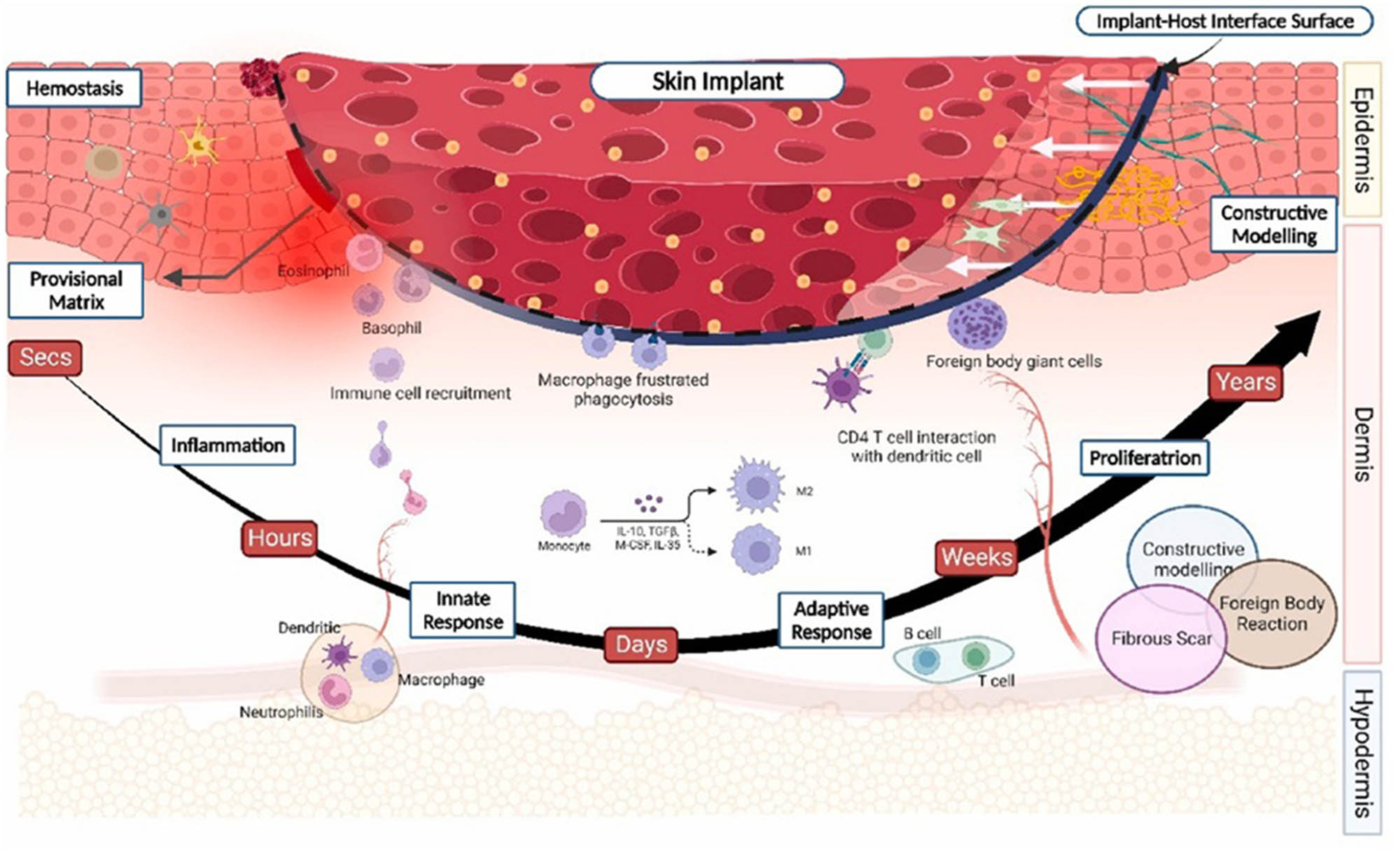 Figure 7 
               Implementation of the biomaterial in the skin [47].
            